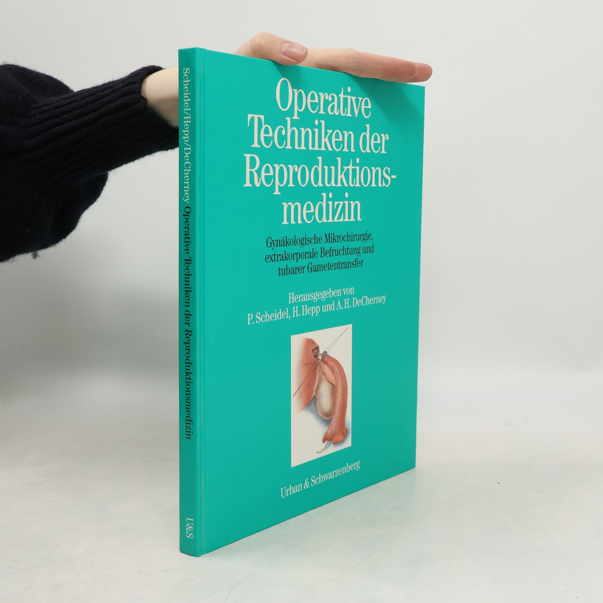 Peter Scheidel Operative Techniken der Reproduktionsmedizin
