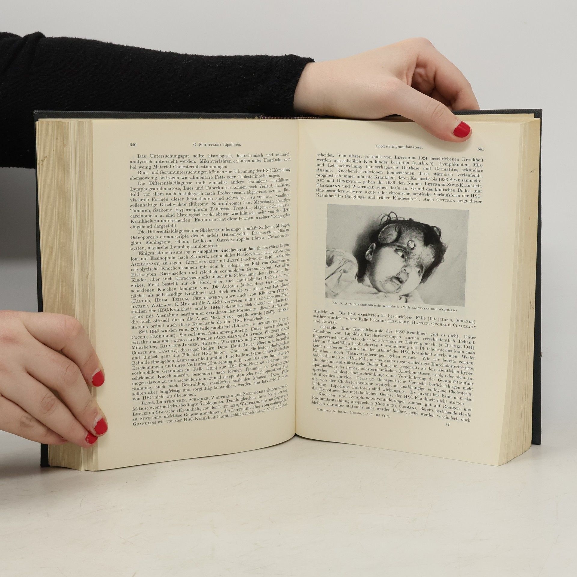 Ludwig Heilmeyer Handbuch Der Inneren Medizin