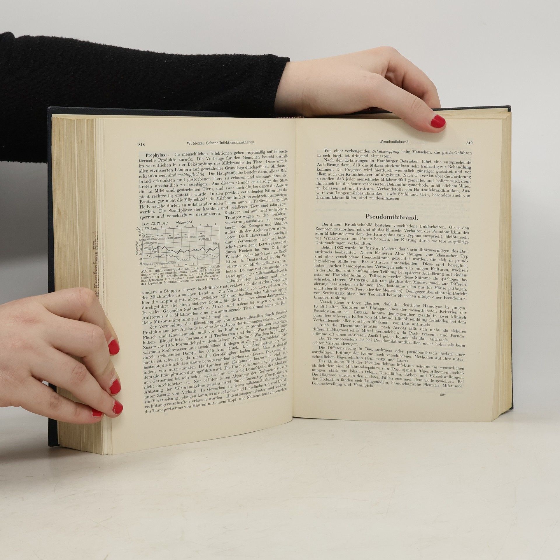 Ludwig Heilmeyer Handbuch Der Inneren Medizin