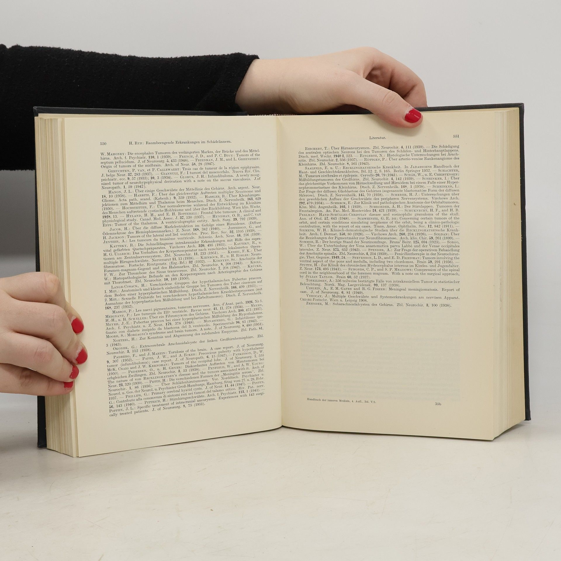 Ludwig Heilmeyer Handbuch Der Inneren Medizin