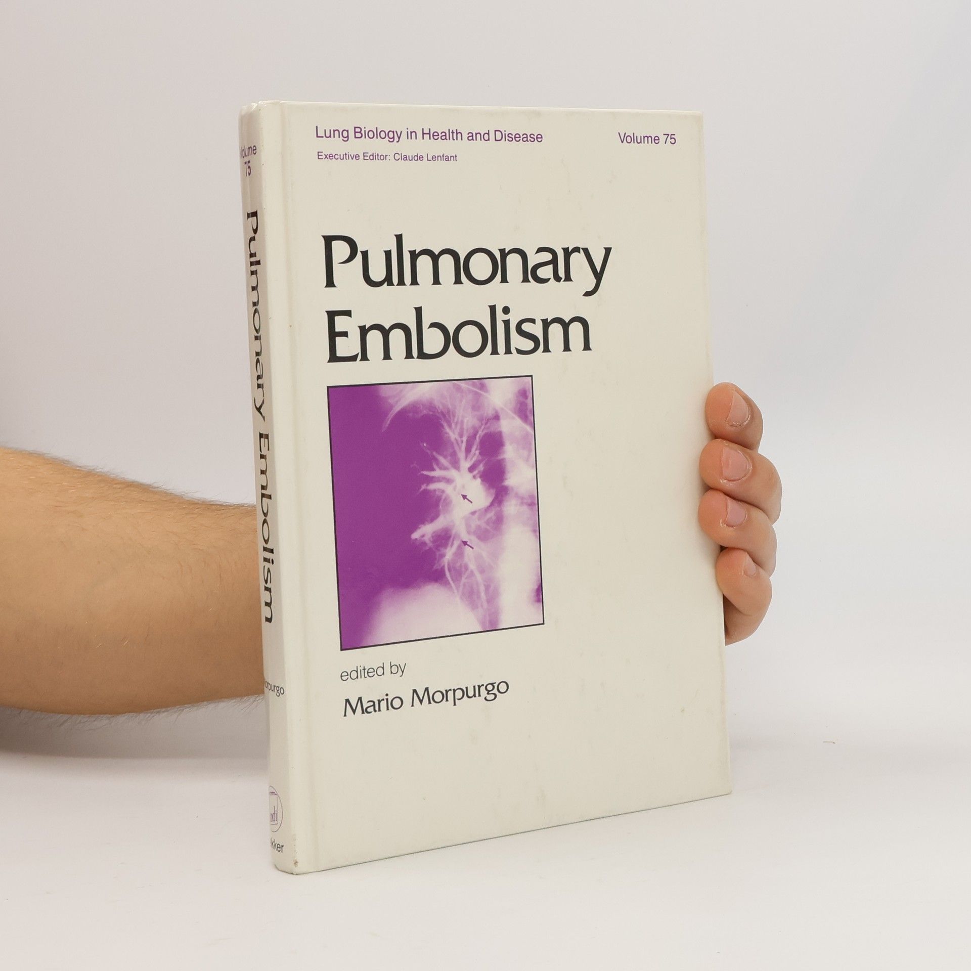 Mario Morpurgo Pulmonary Embolism