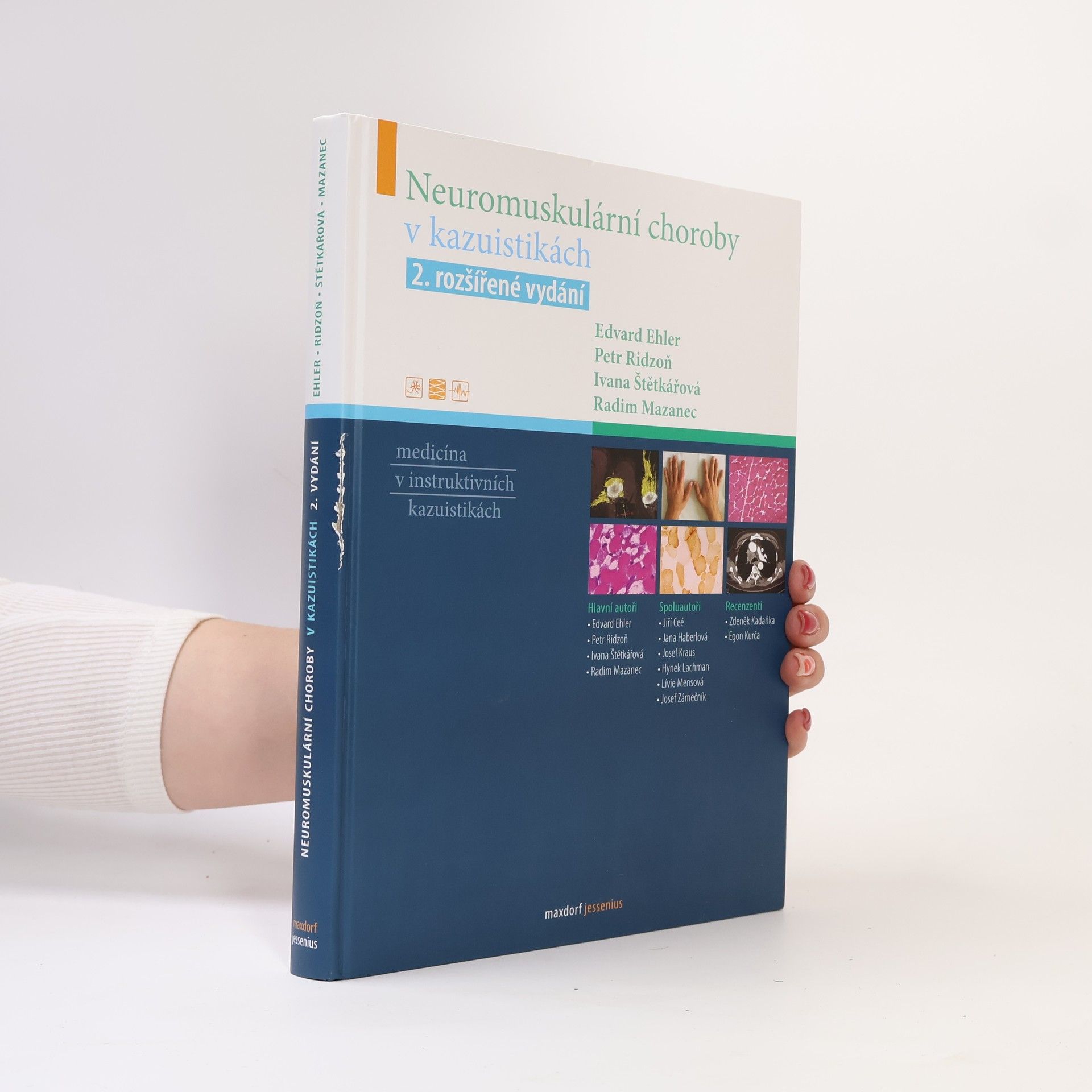 Neuromuskulární choroby v kazuistikách