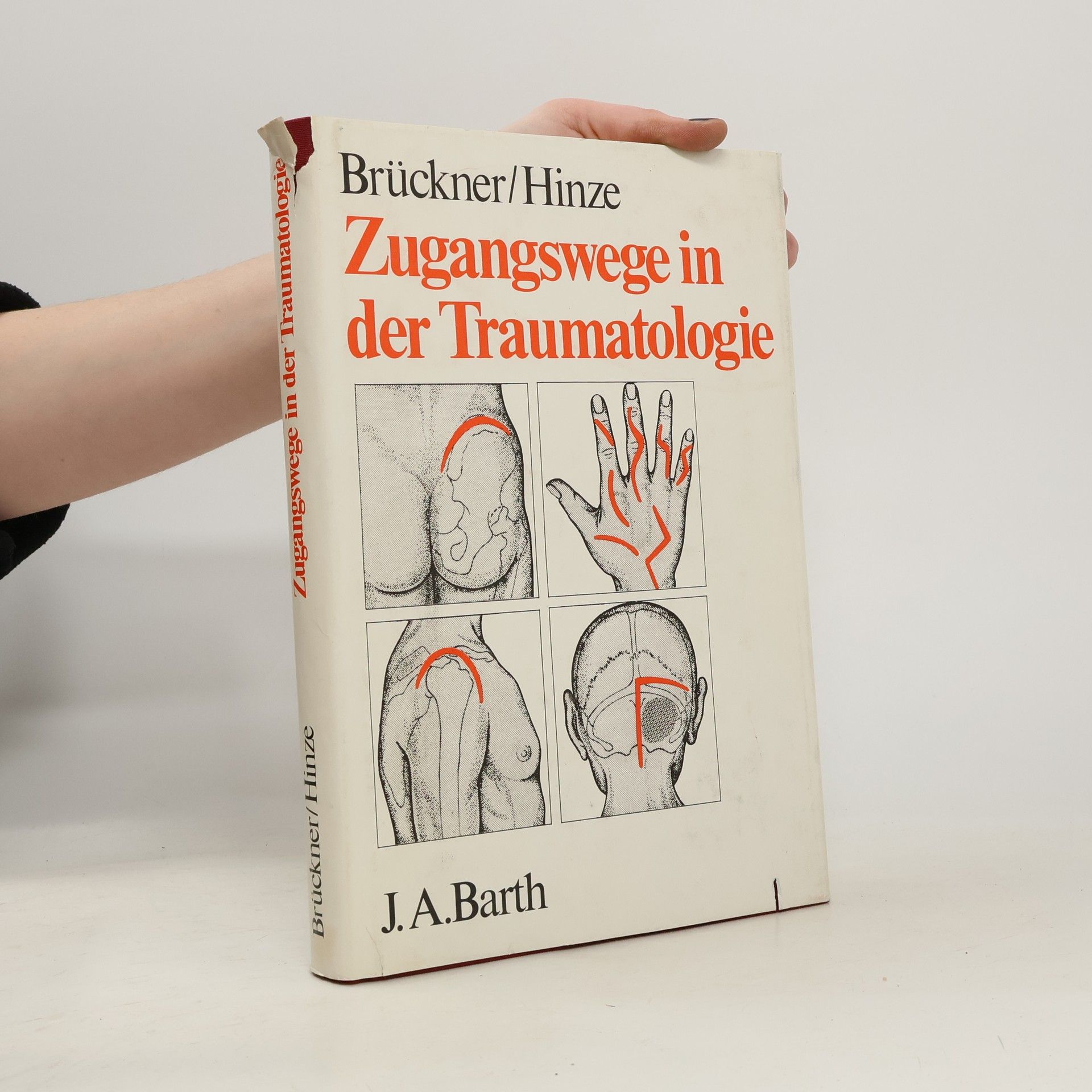 Helmut Bruckner Zugangswege in der Traumatologie