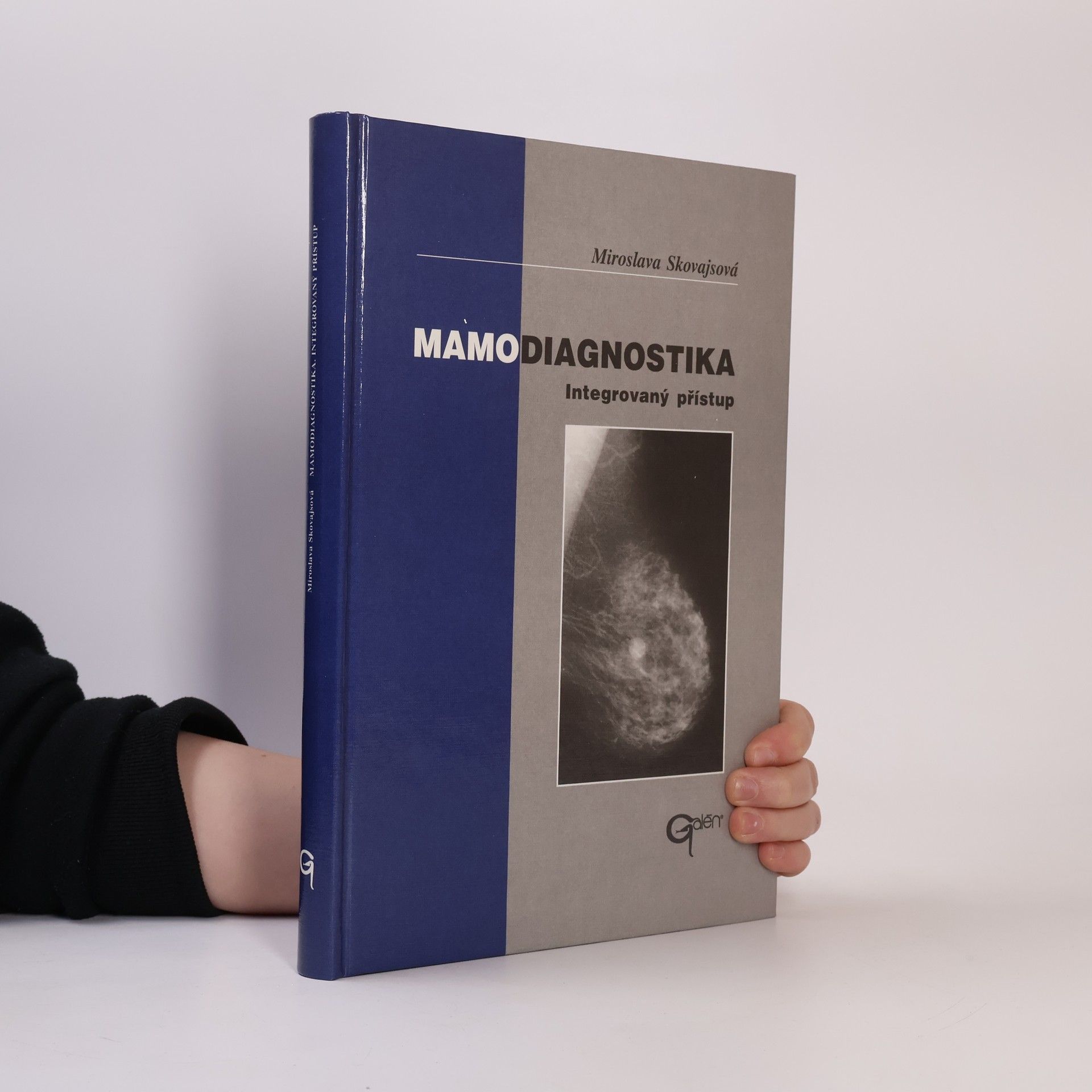 Miroslava Skovajsová Mamodiagnostika