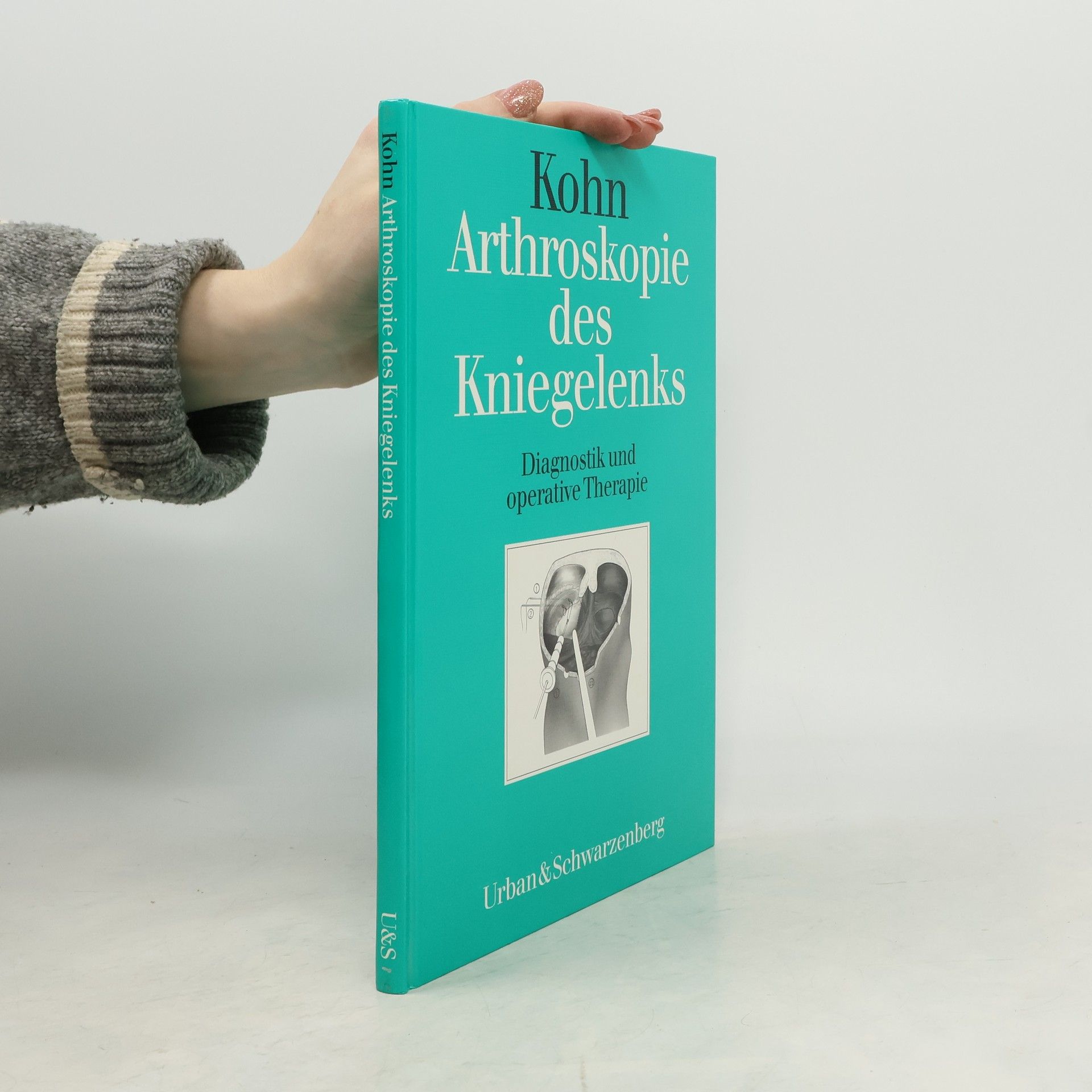 Dieter Kohn Arthroskopie des Kniegelenks