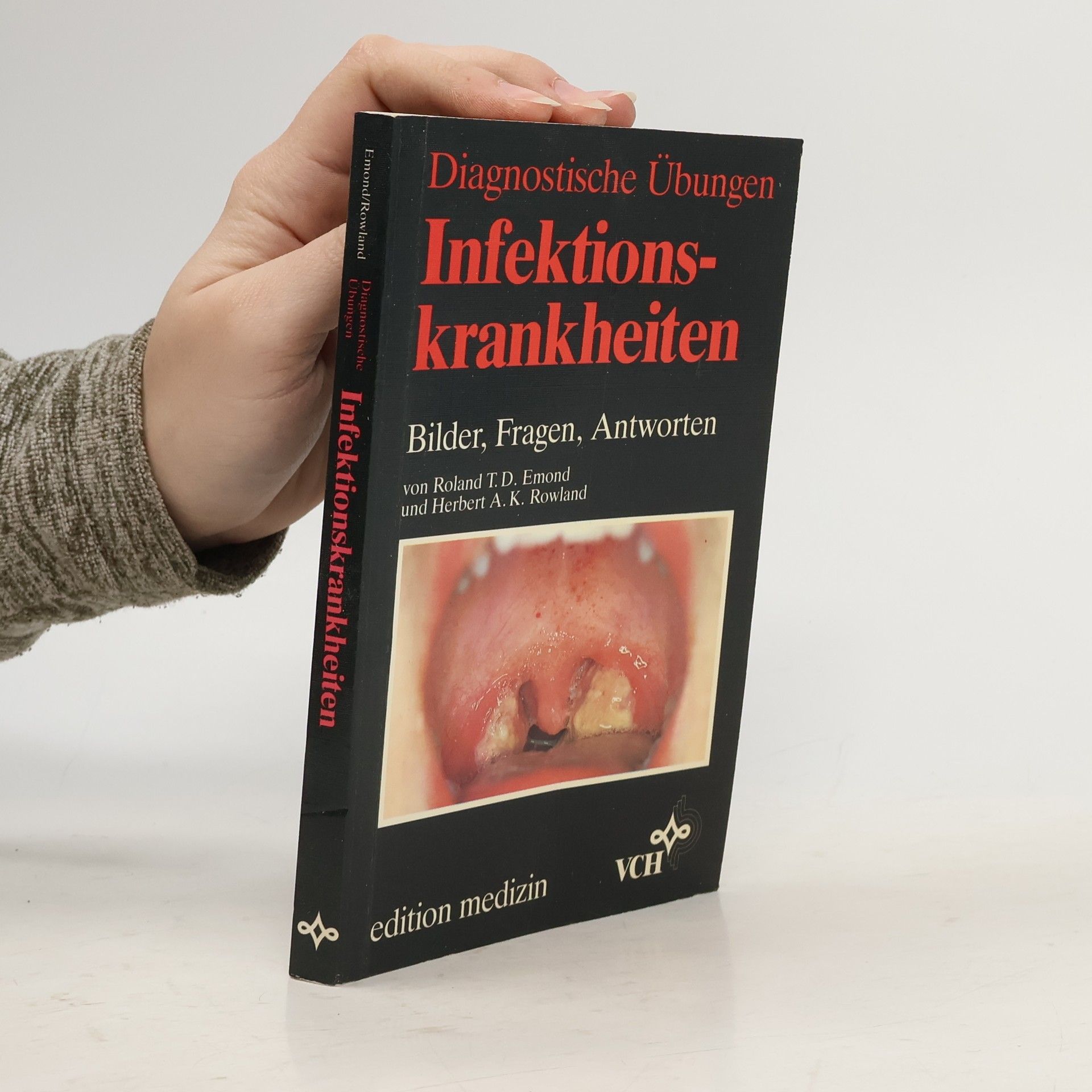 Roland T. D. Emond Diagnostische Übungen Infektionskrankheiten