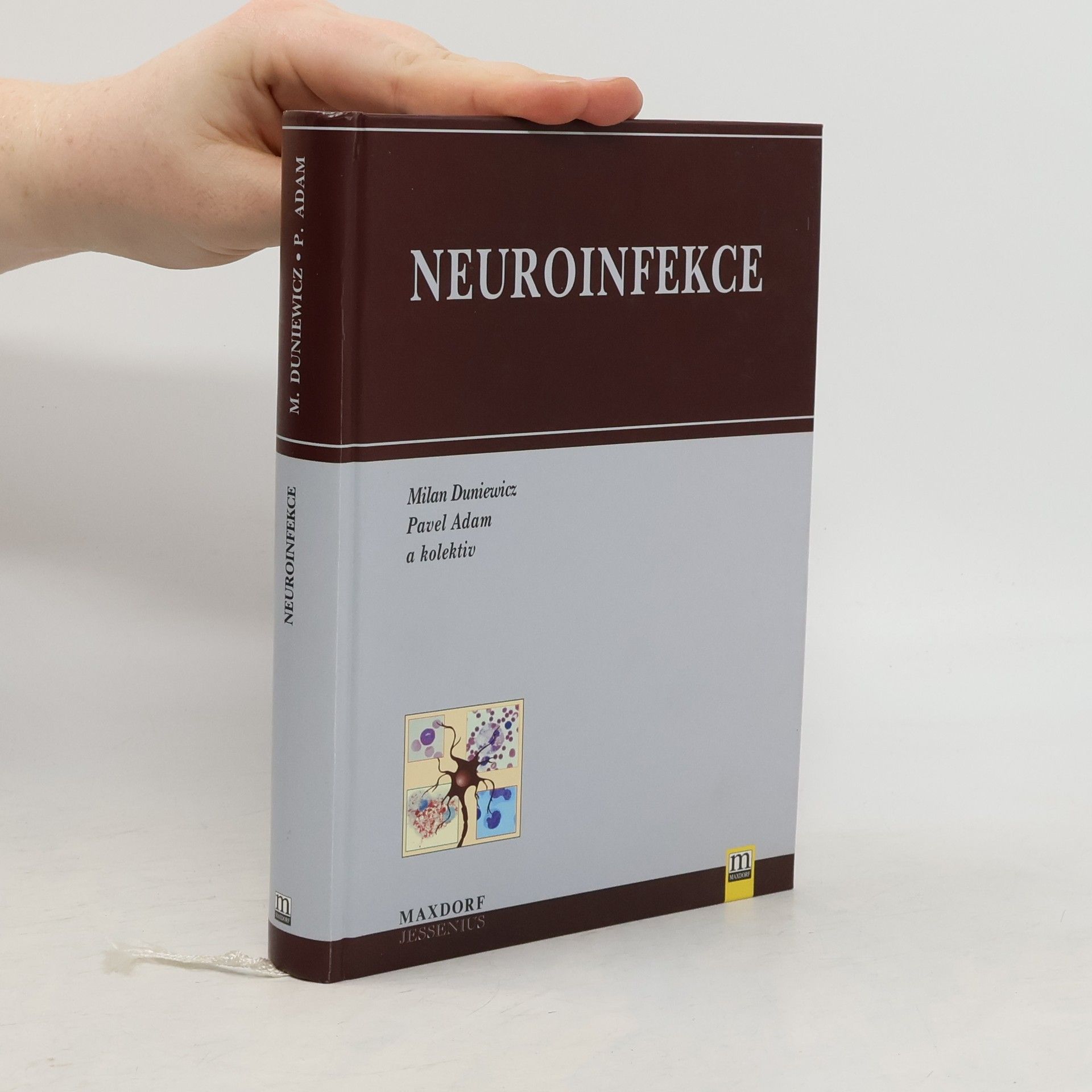 Autorenkollektiv Neuroinfekce