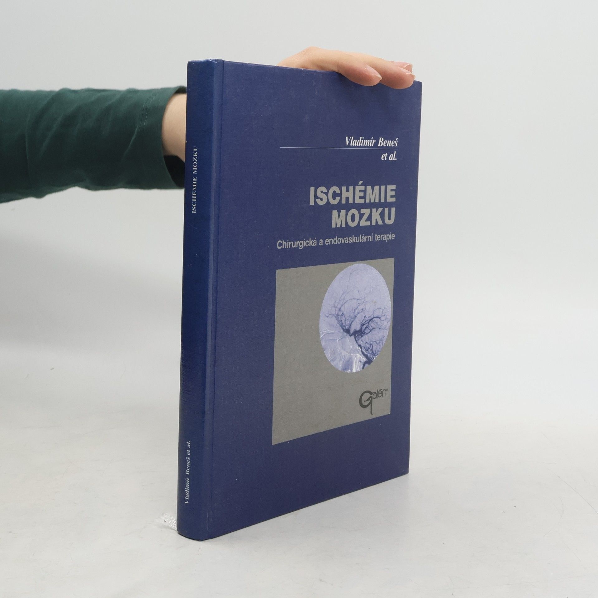 Vladimír Beneš Ischémie mozku