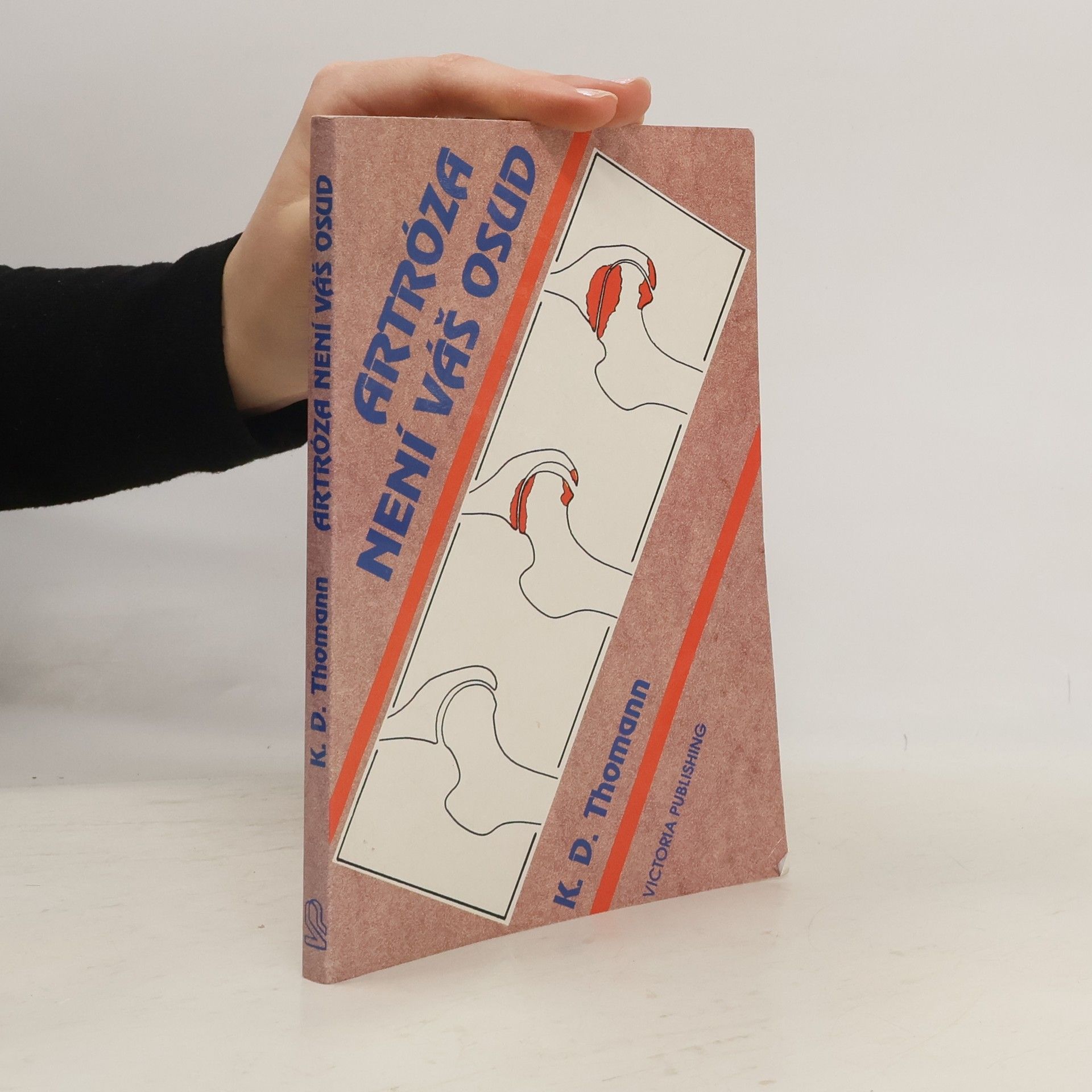 Klaus Dieter Thomann Artróza není váš osud