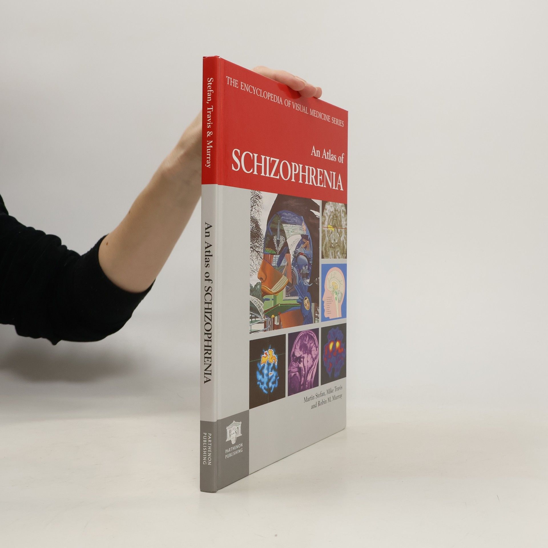 Stefan Martin The Encyclopedia of Visual Medicine Series. An Atlas of Schizophrenia