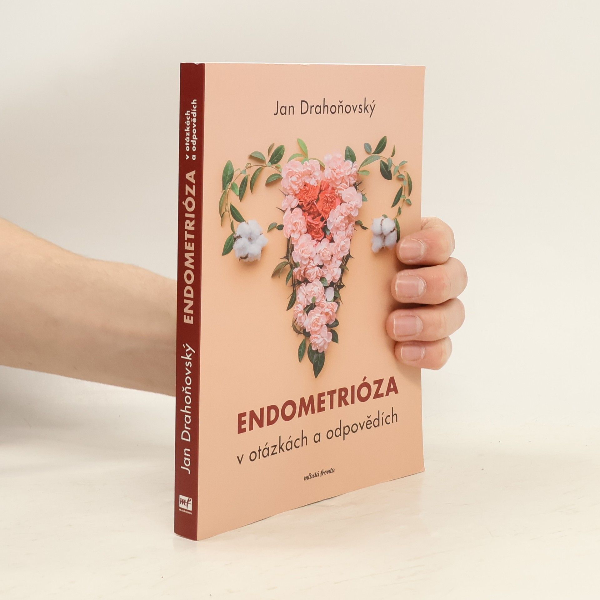 Jan Drahoňovský Endometrióza v otázkách a odpovědích