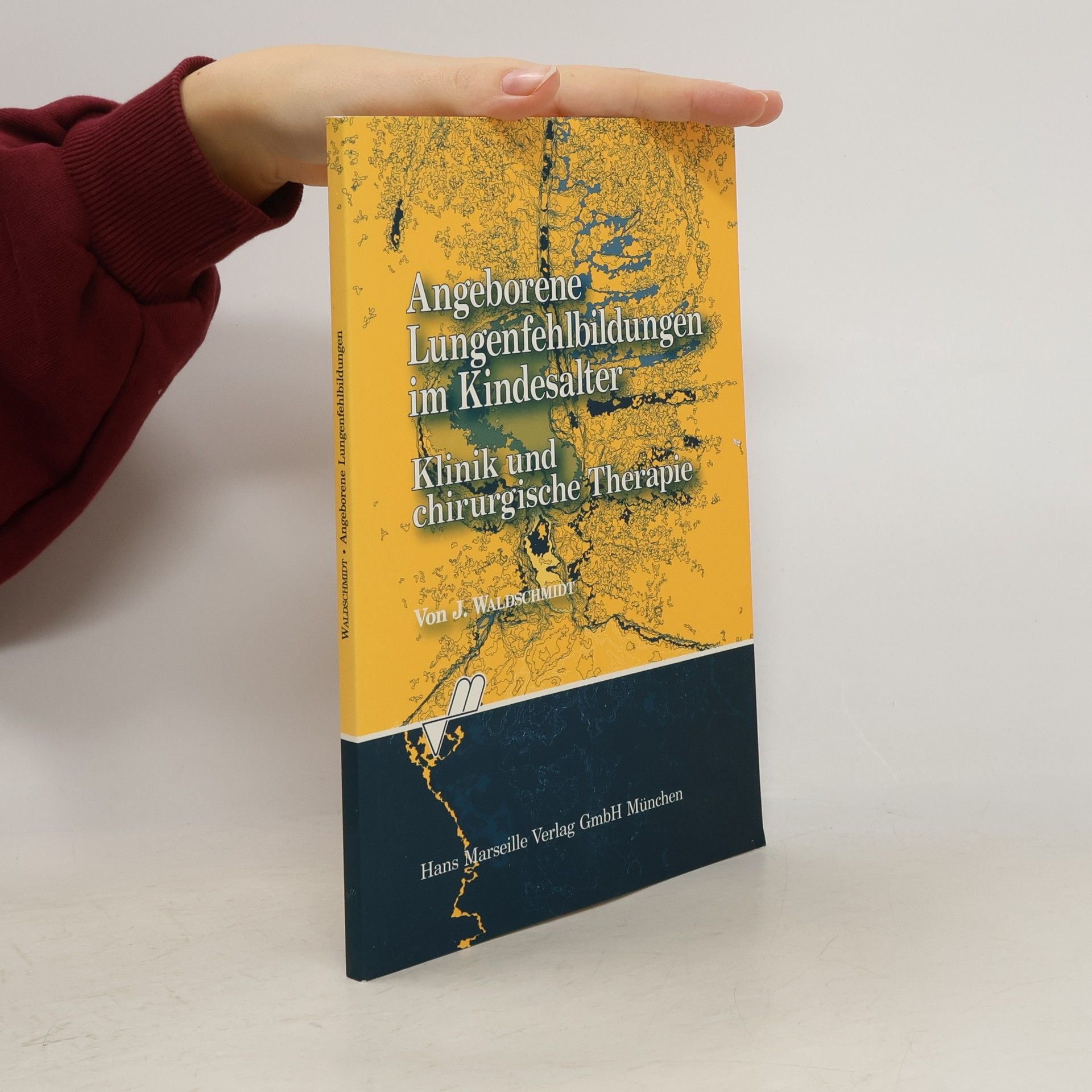 Jürgen Waldschmidt Angeborene Lungenfehlbildungen im Kindesalter