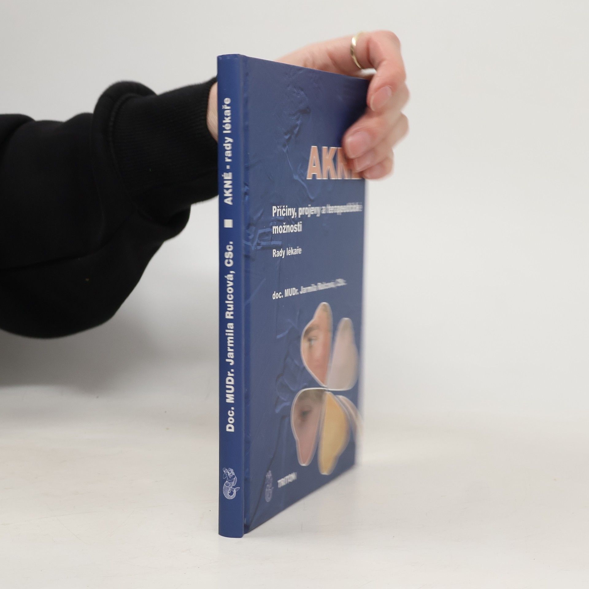 Jarmila Rulcová Akné: příčiny, projevy a terapeutické možnosti: rady lékaře