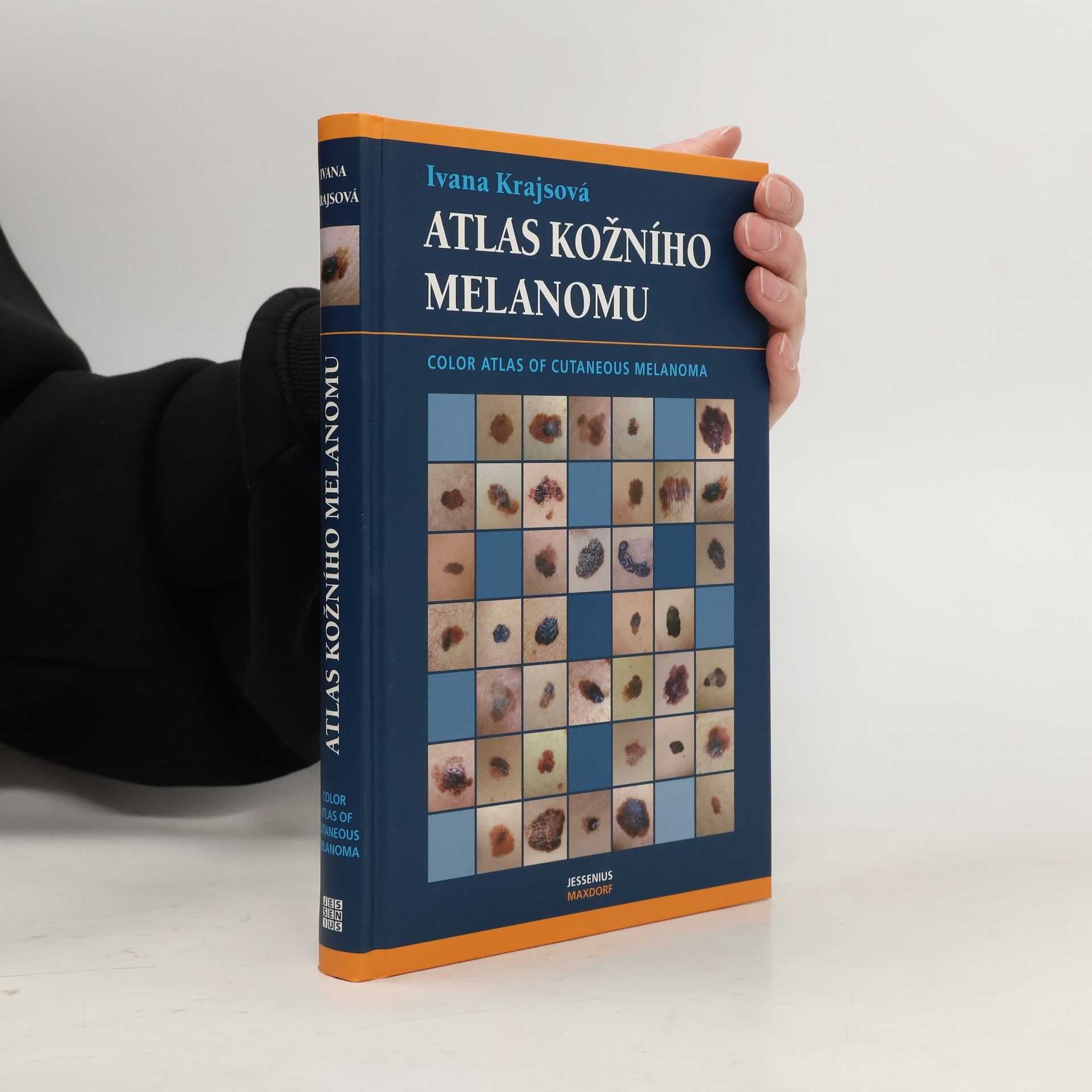 Ivana Krajsová Atlas kožního melanomu