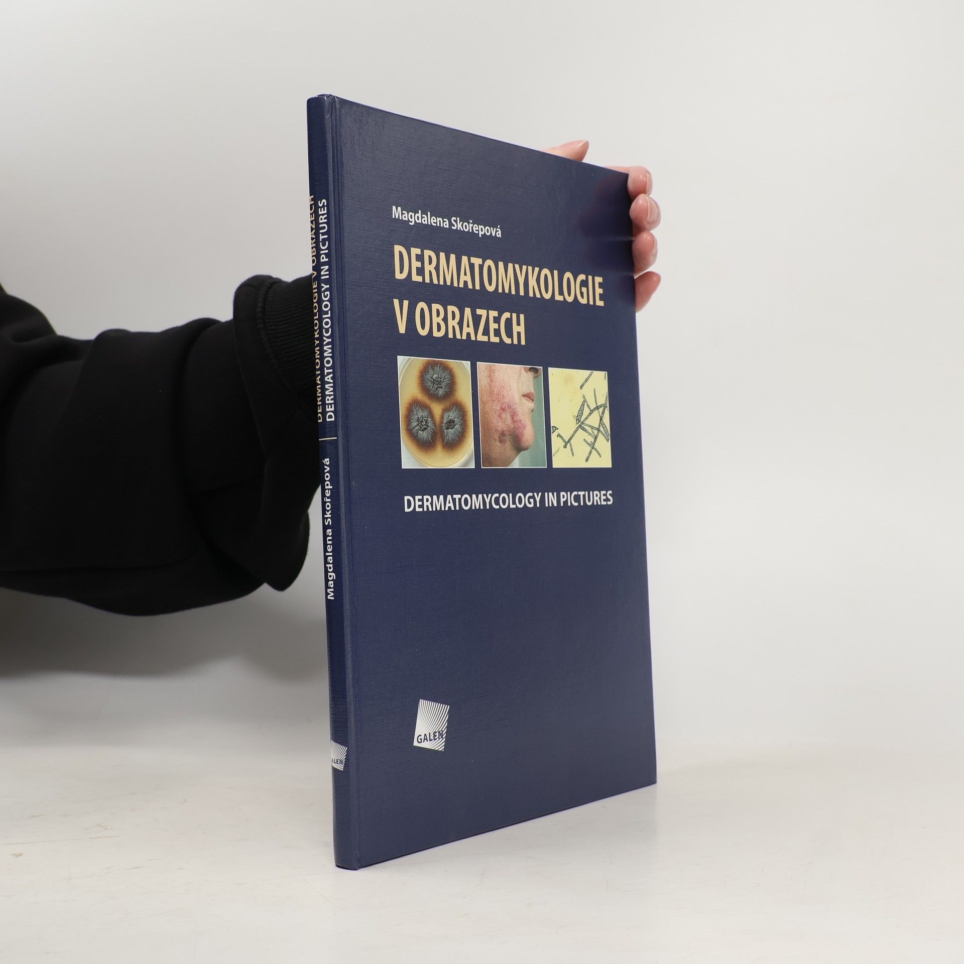 Dermatomykologie v obrazech