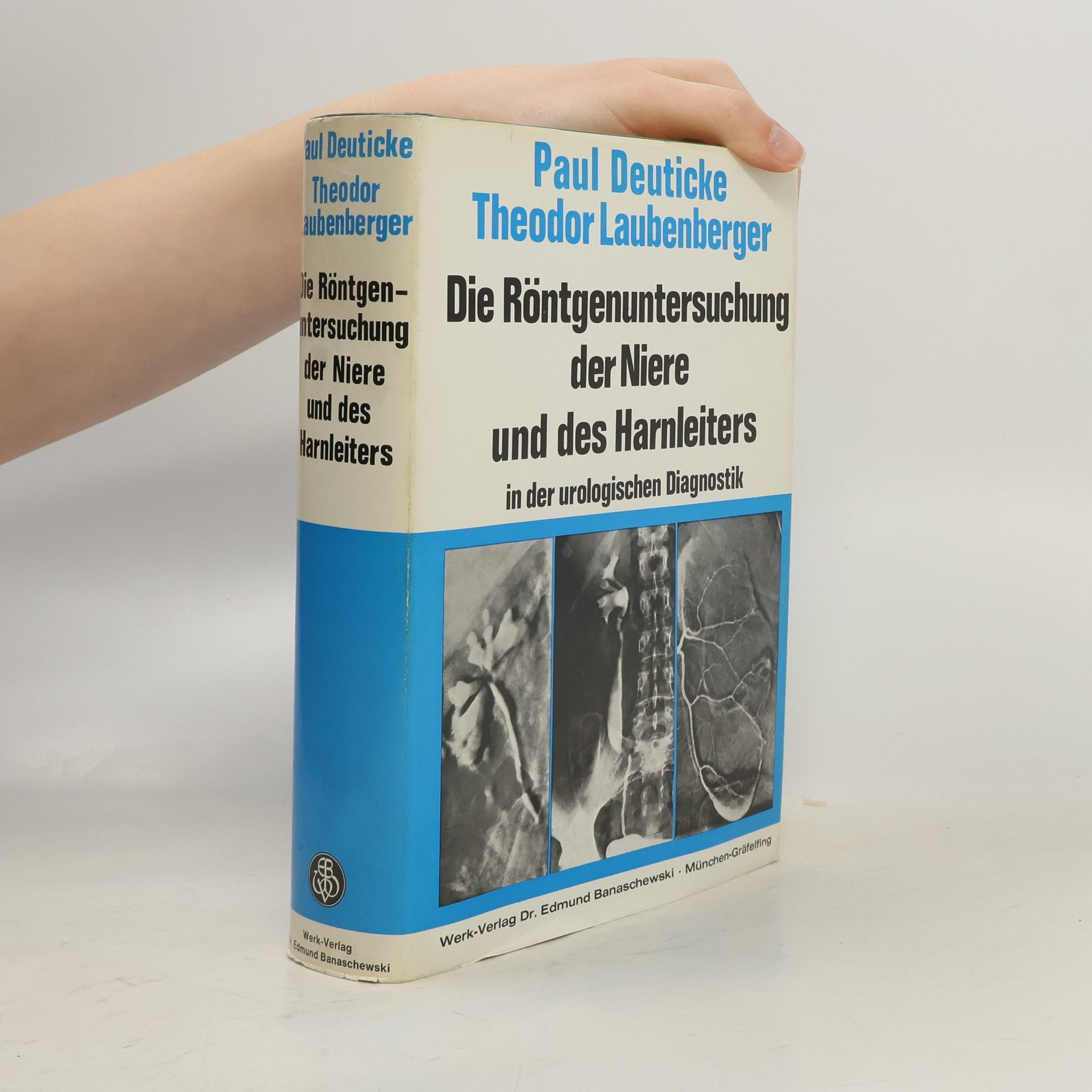 Paul Deuticke Die Röntgenuntersuchung der Niere und des Harnleiters in der urologischen Diagnostik
