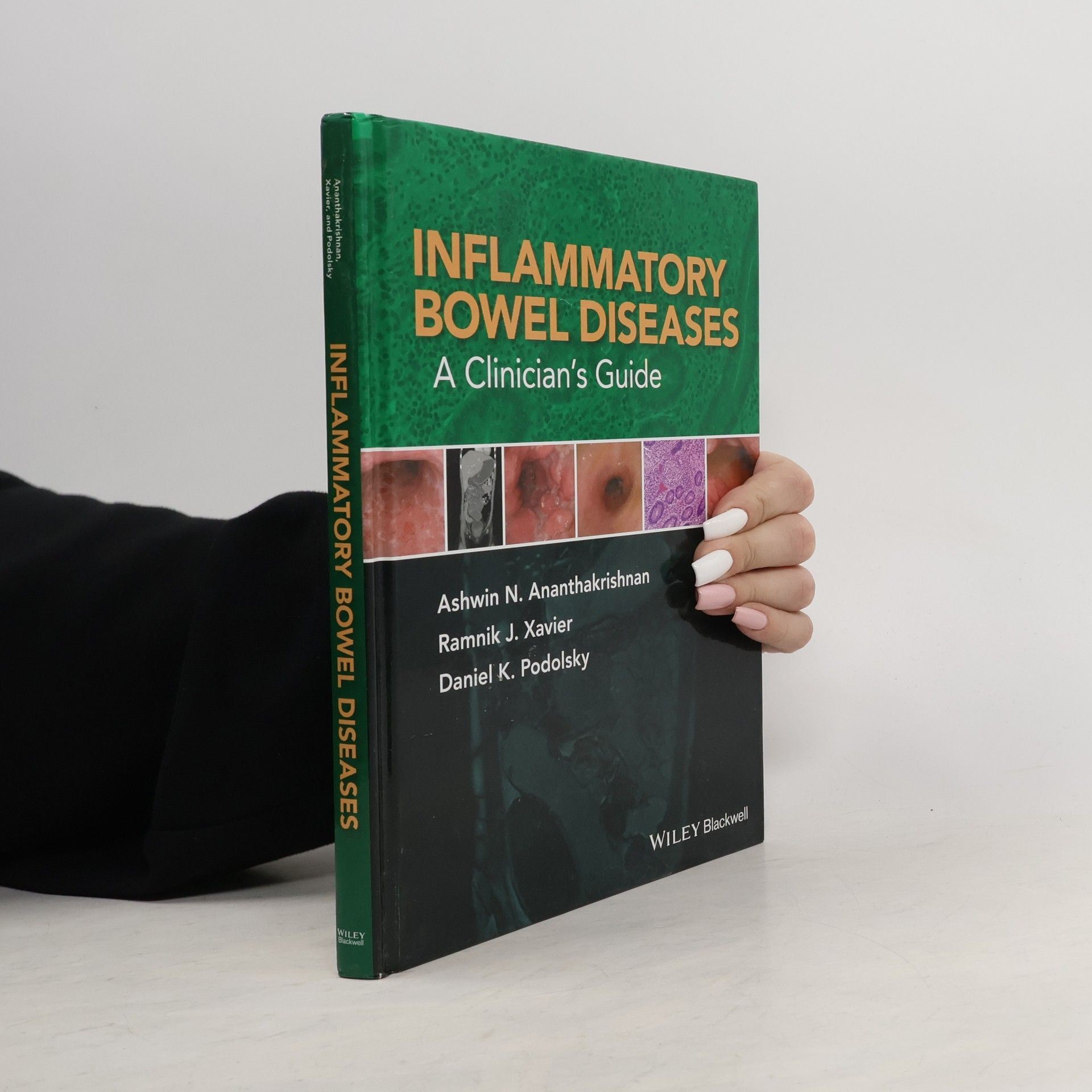 Ashwin N. Ananthakrishnan Inflammatory Bowel Diseases