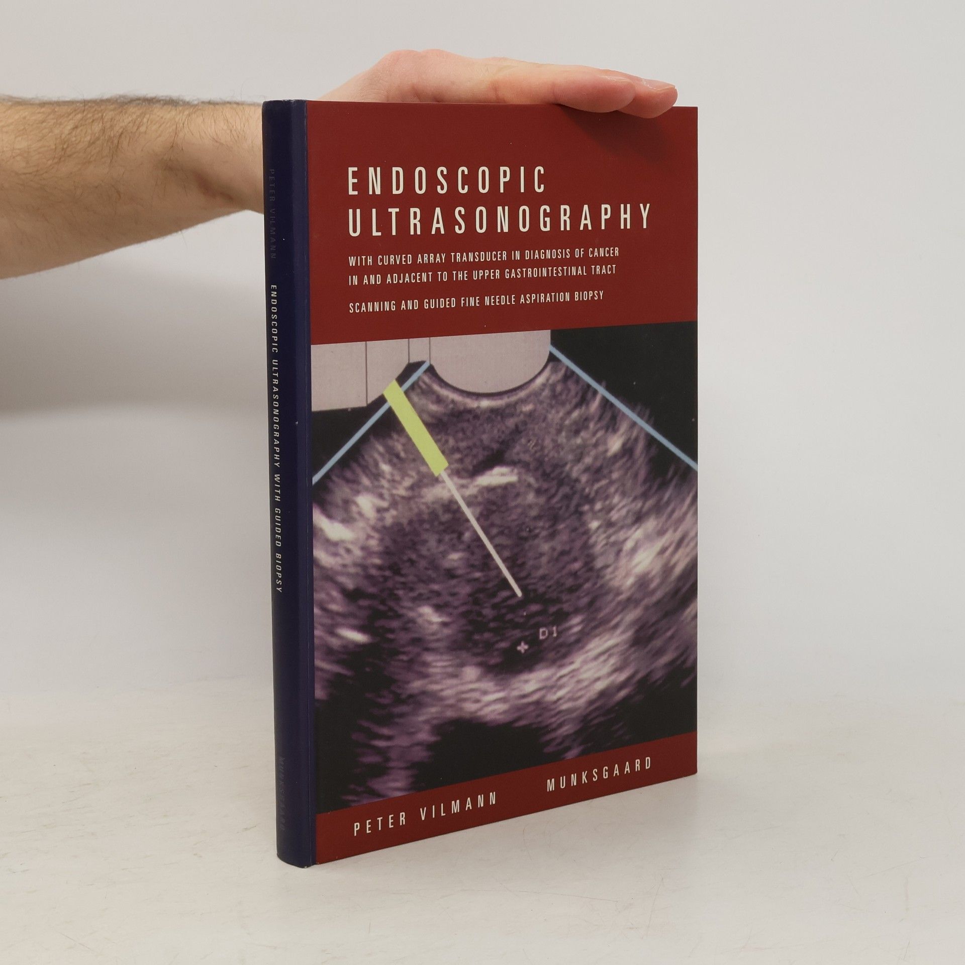 Peter Vilmann Endoscopic Ultrasonography