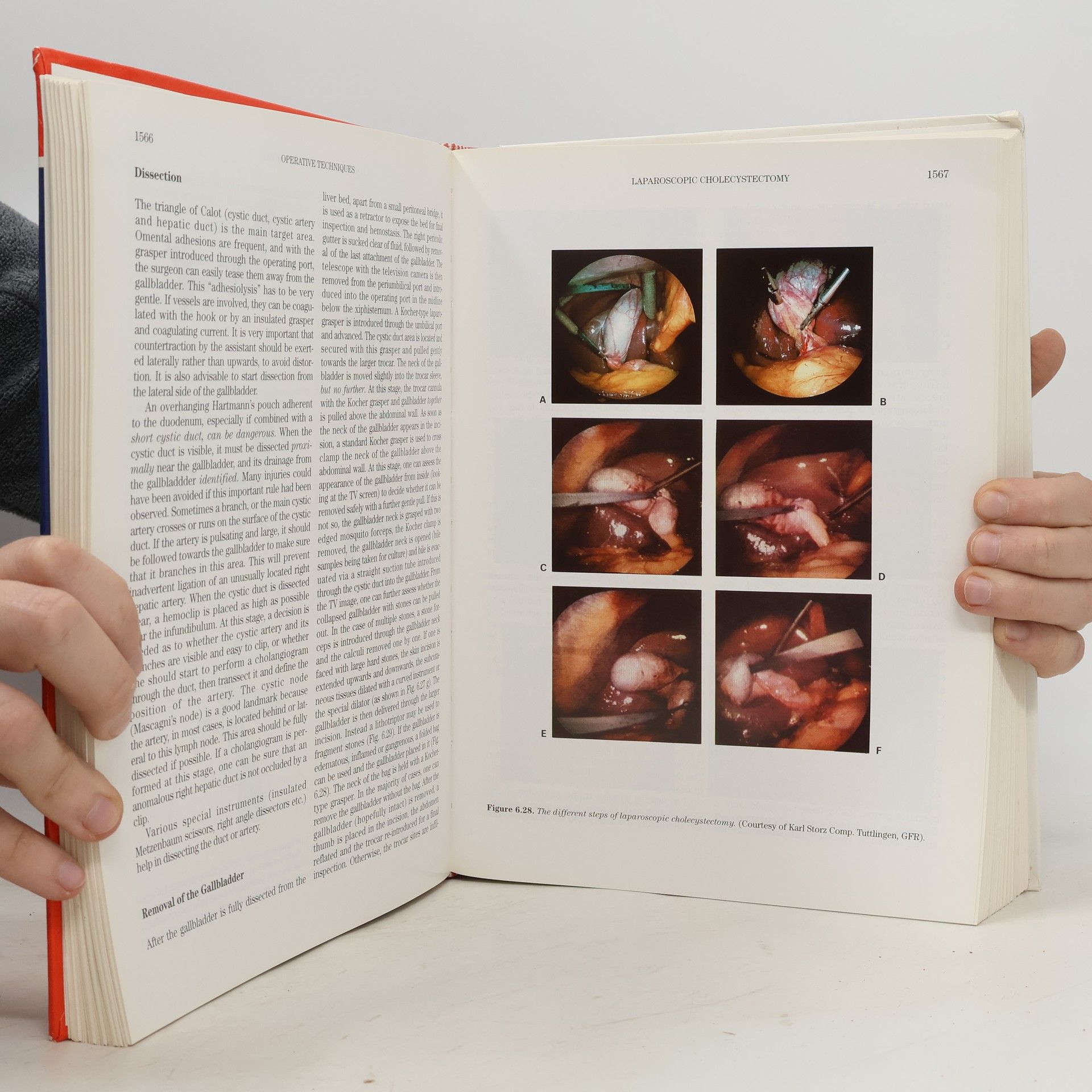 Walter Hess Textbook of Biliopancreatic Diseases