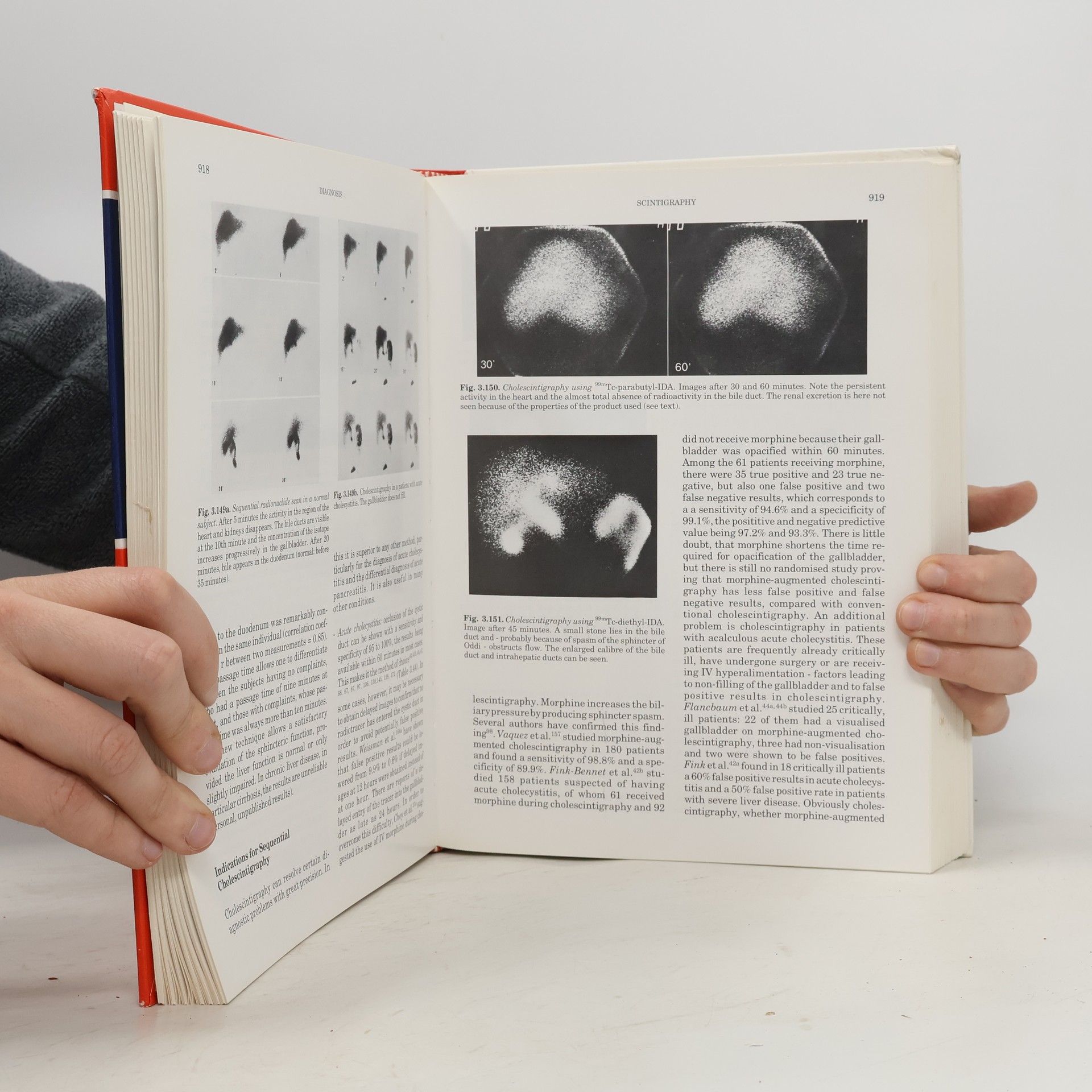 Walter Hess Textbook of Biliopancreatic Diseases