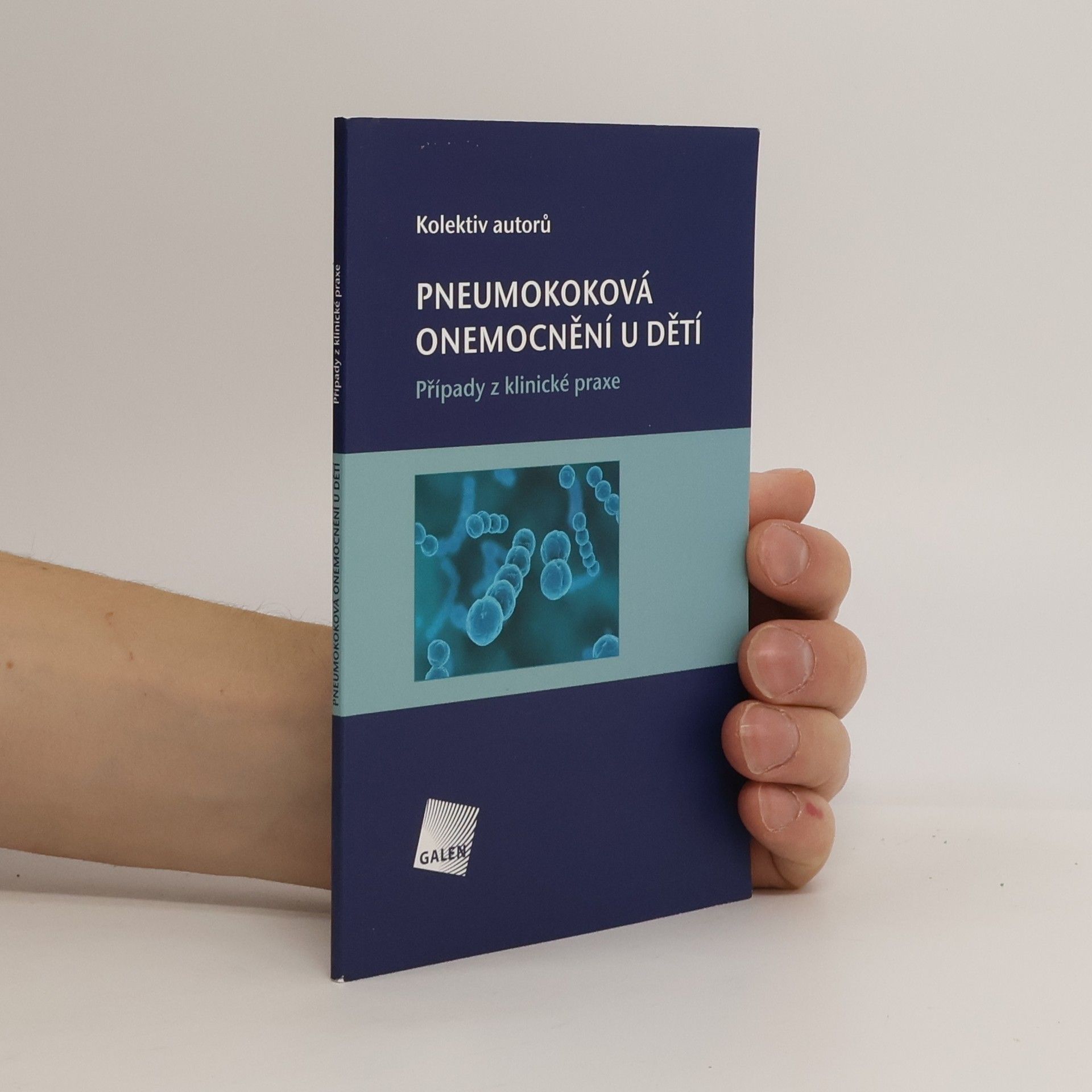 Kateřina Fabichová Pneumokoková onemocnění u dětí