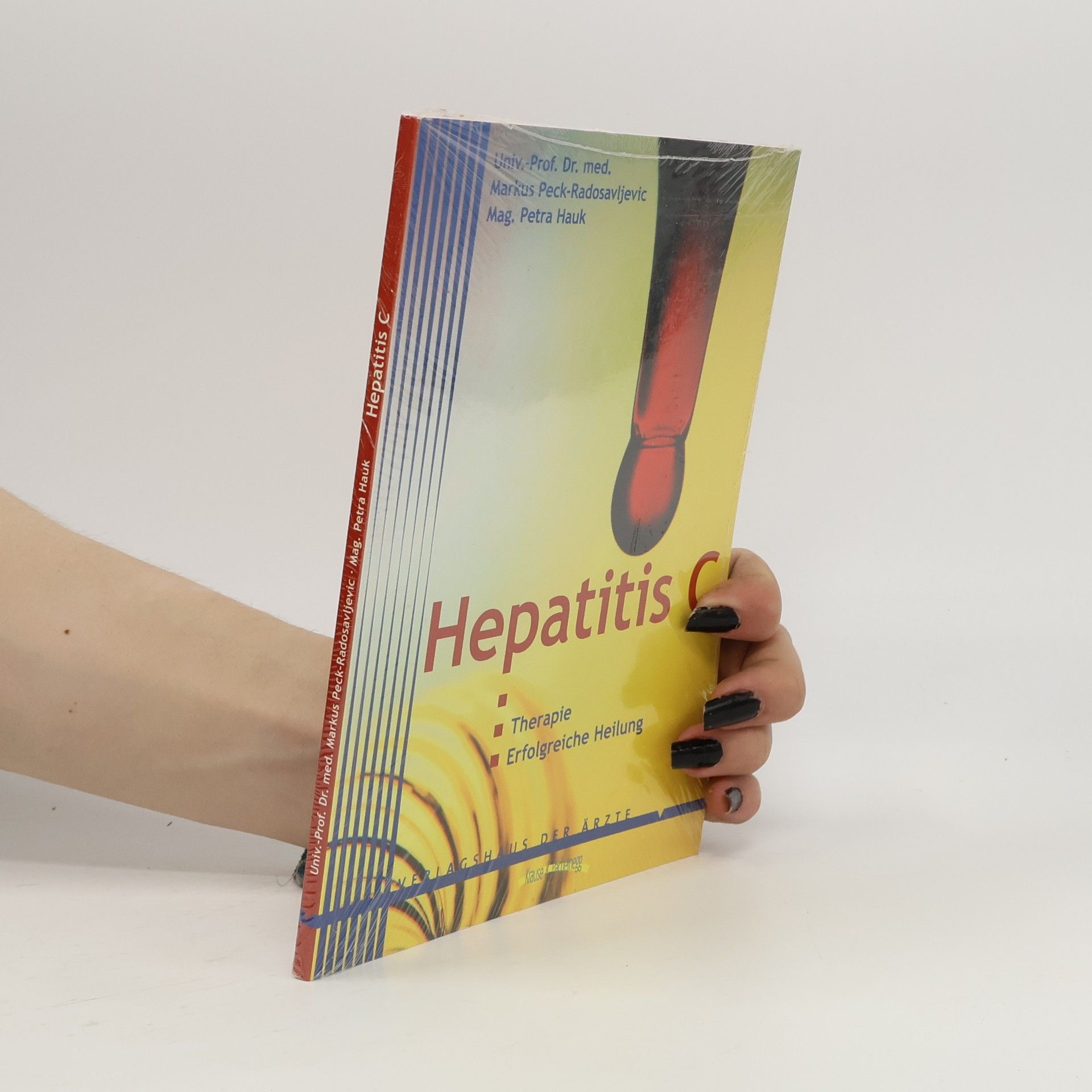 Markus Peck Radosavljevic Hepatitis C