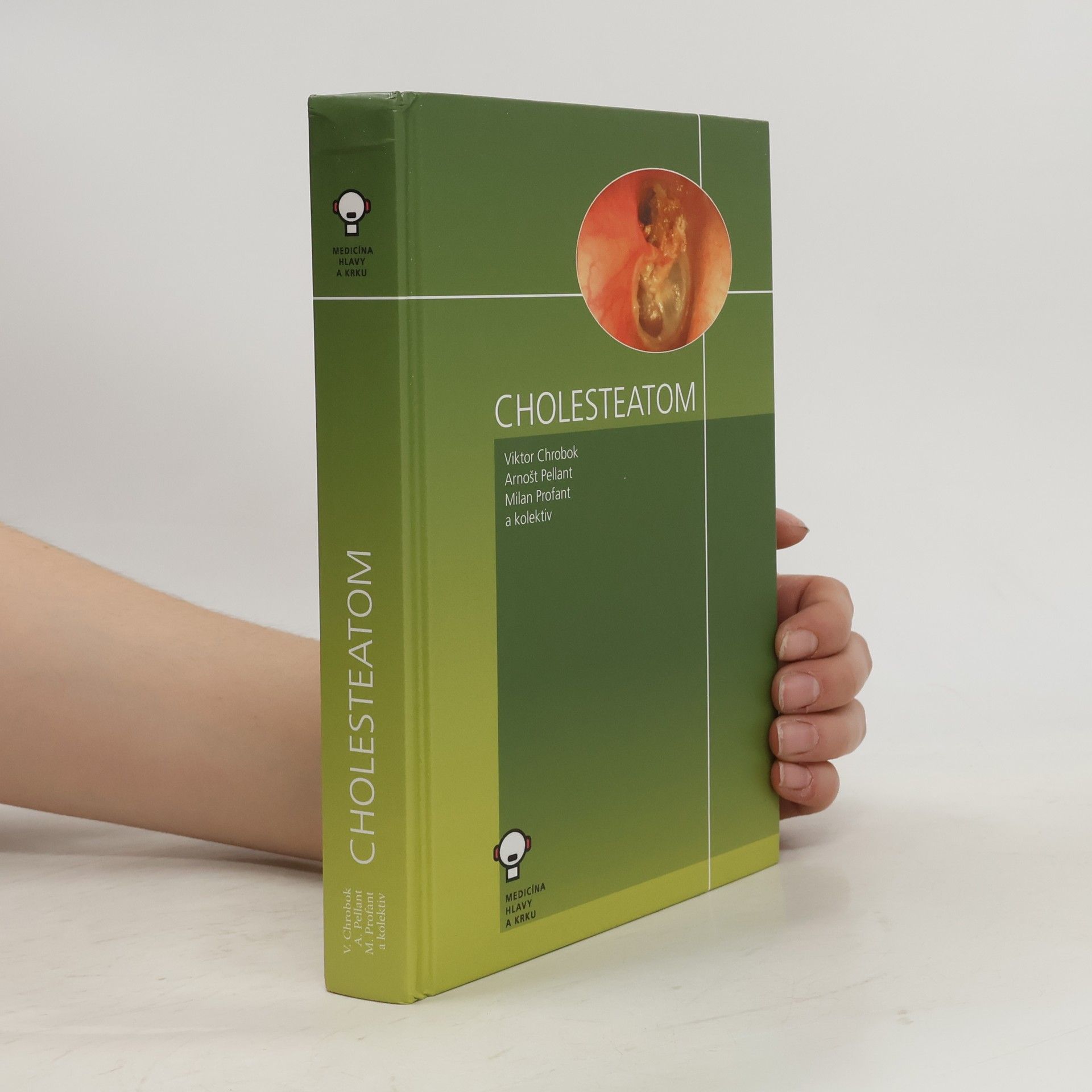 Milan Profant Cholesteatom