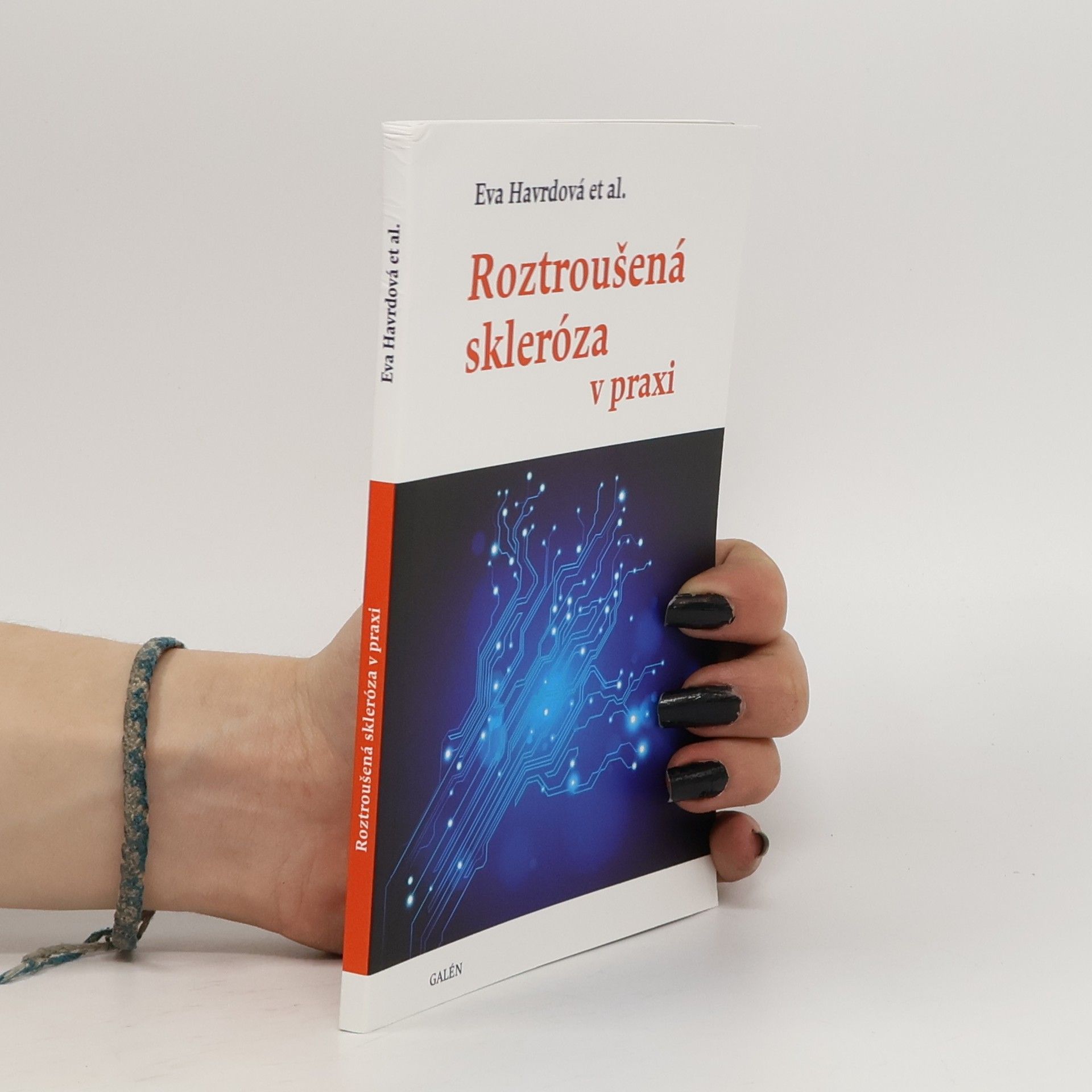 Eva Kubala Havrdová Roztroušená skleróza v praxi