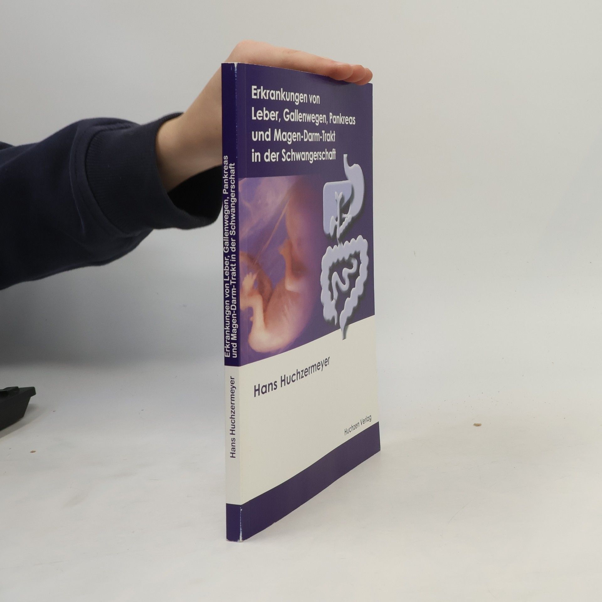 Hans Huchzermeyer Erkrankungen von Leber, Gallenwegen, Pankreas und Magen-Darm-Trakt in der Schwangerschaft
