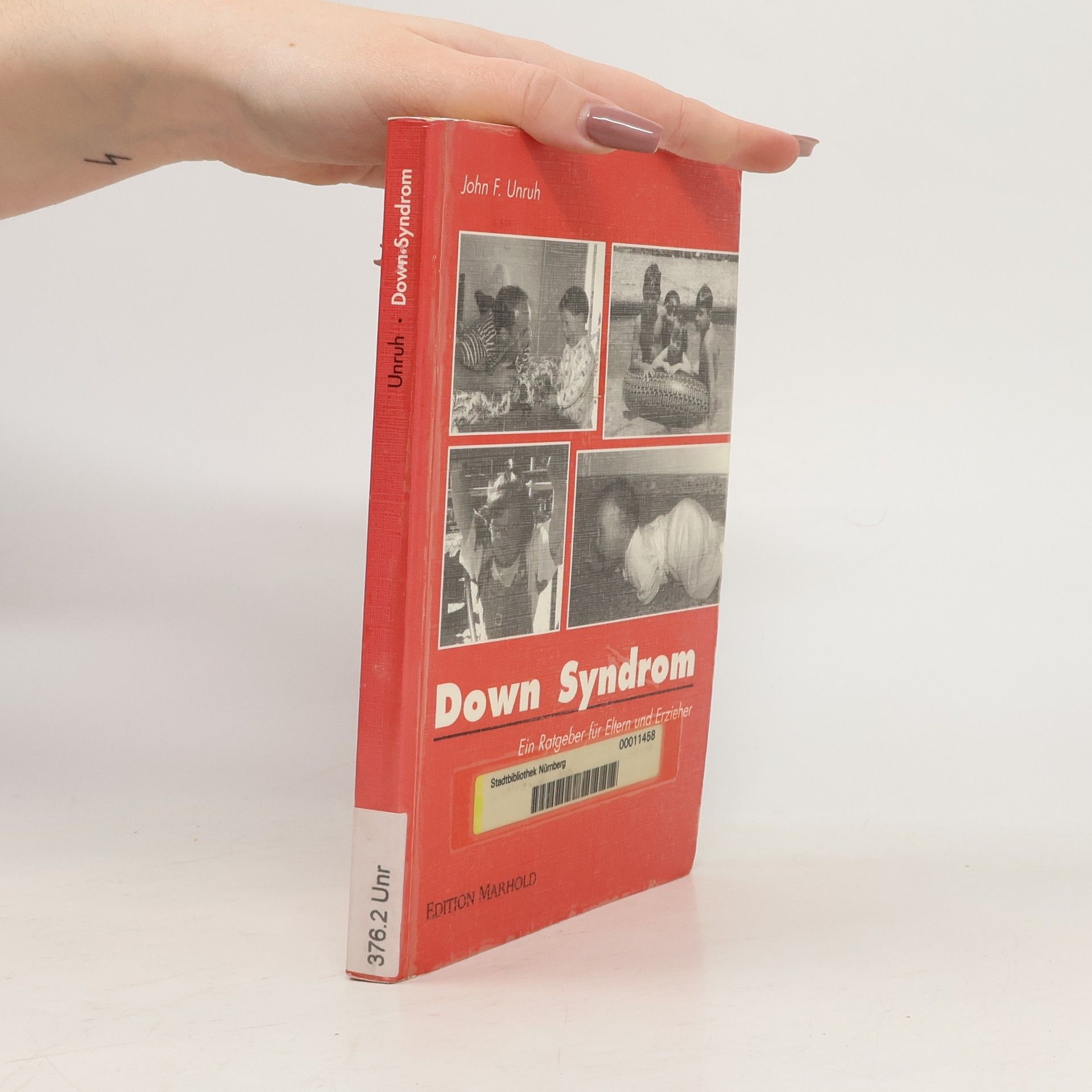 John F. Unruh Down Syndrom