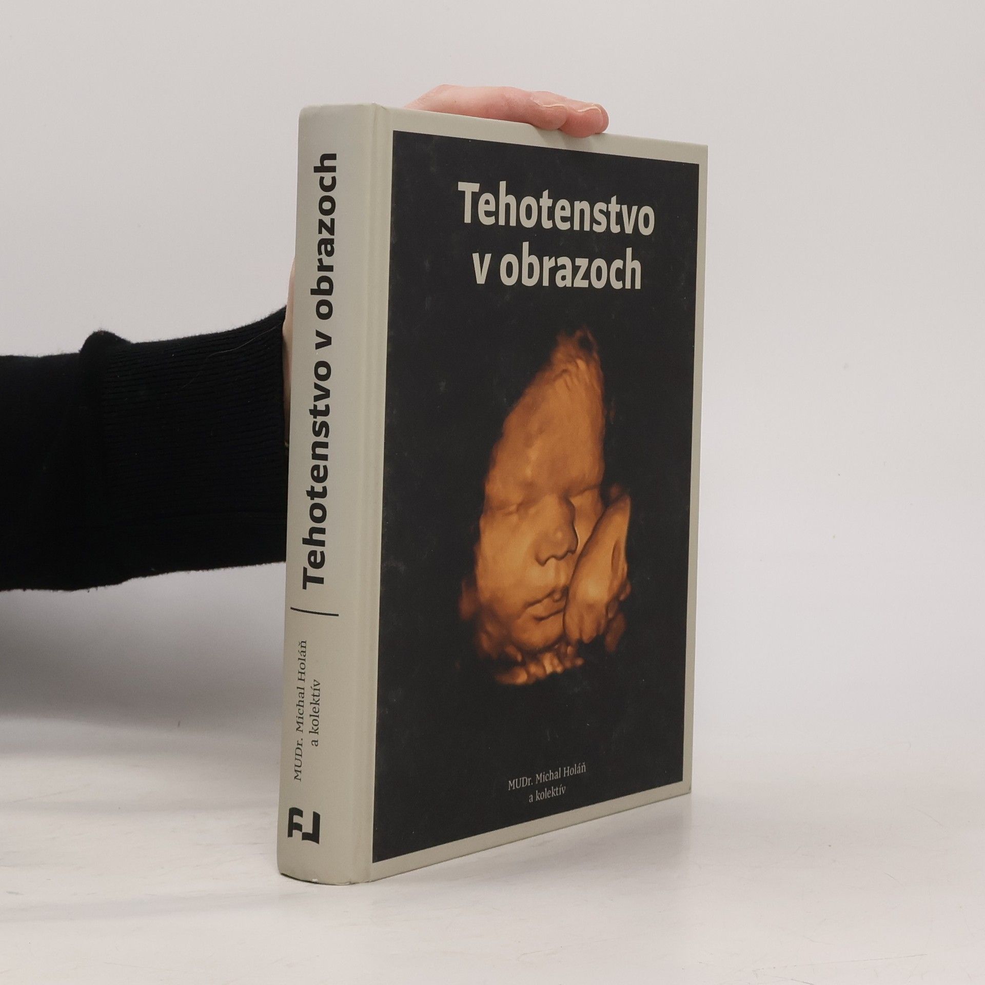 Kolektiv autorů Tehotenstvo v obrazoch