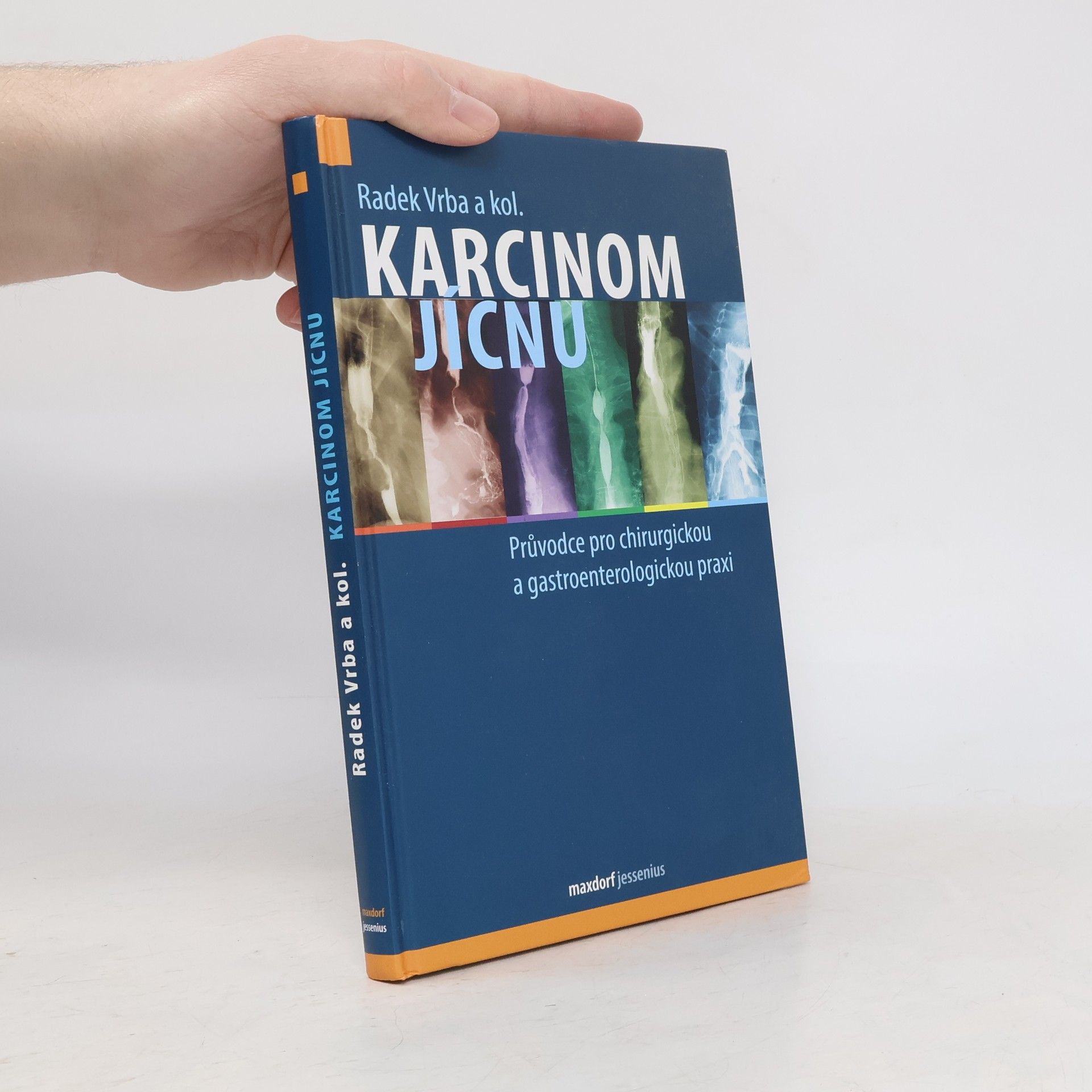 Radek Vrba Karcinom Jícnu