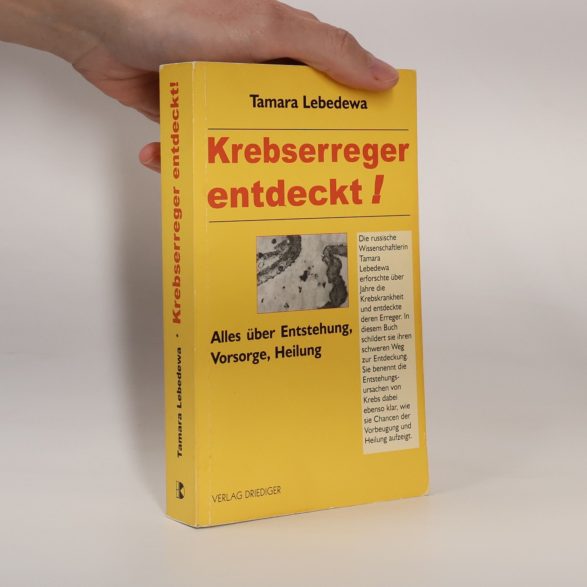 Tamara Lebedeva Krebserreger entdeckt!