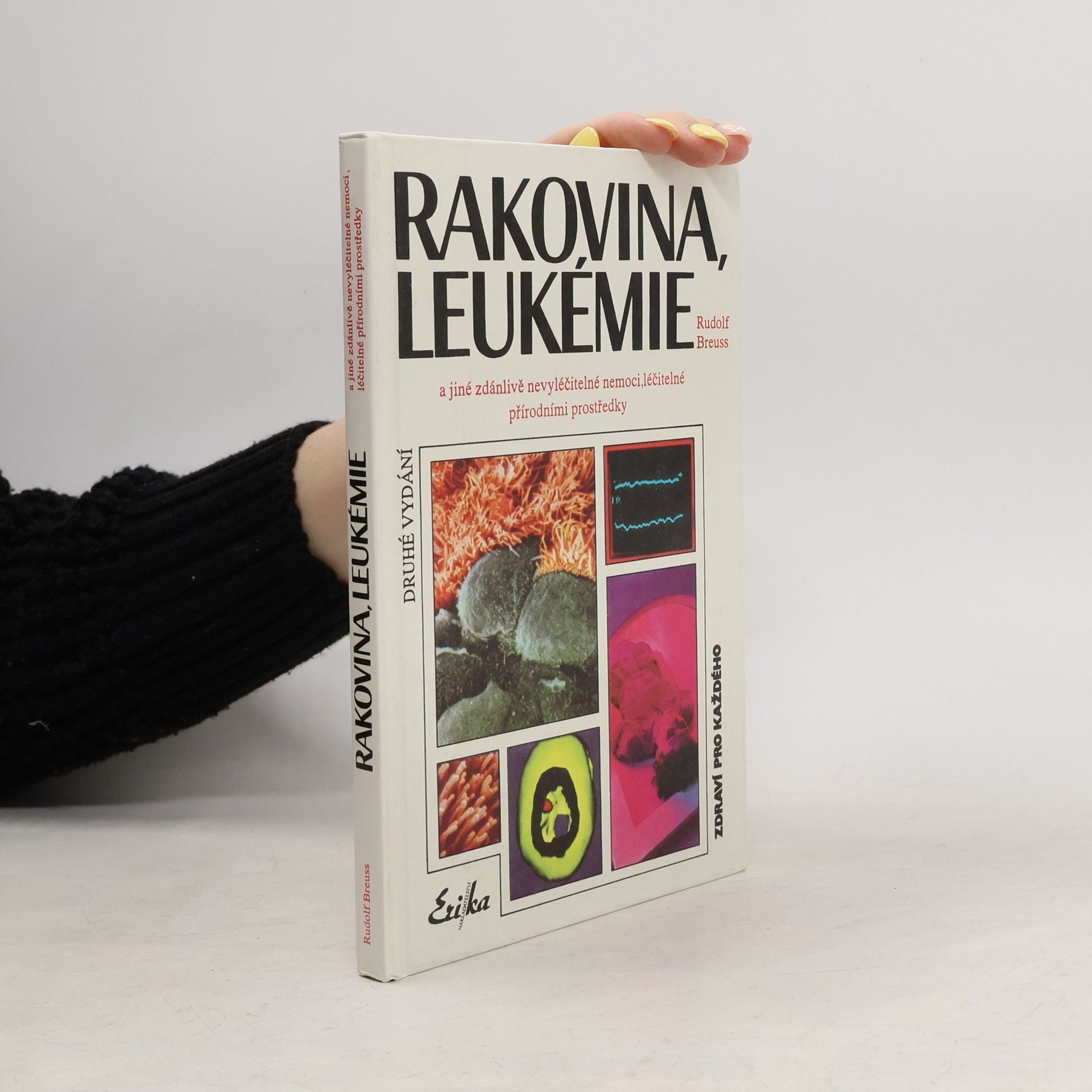 Rudolf Breuss Rakovina, leukémie a jiné zdánlivě nevyléčitelné nemoci, léčitelné přírodními prostředky