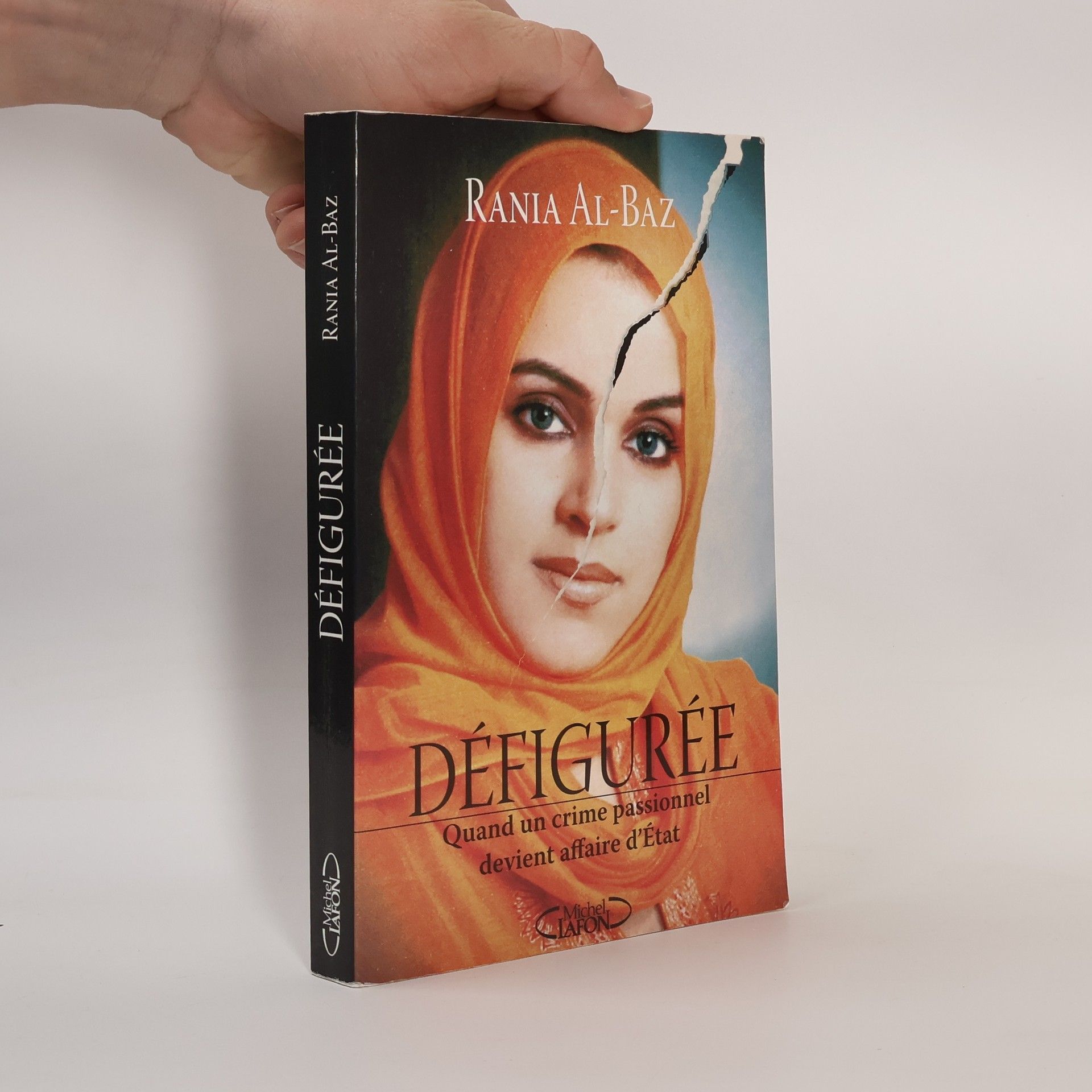 Rania Al-Baz Défigurée