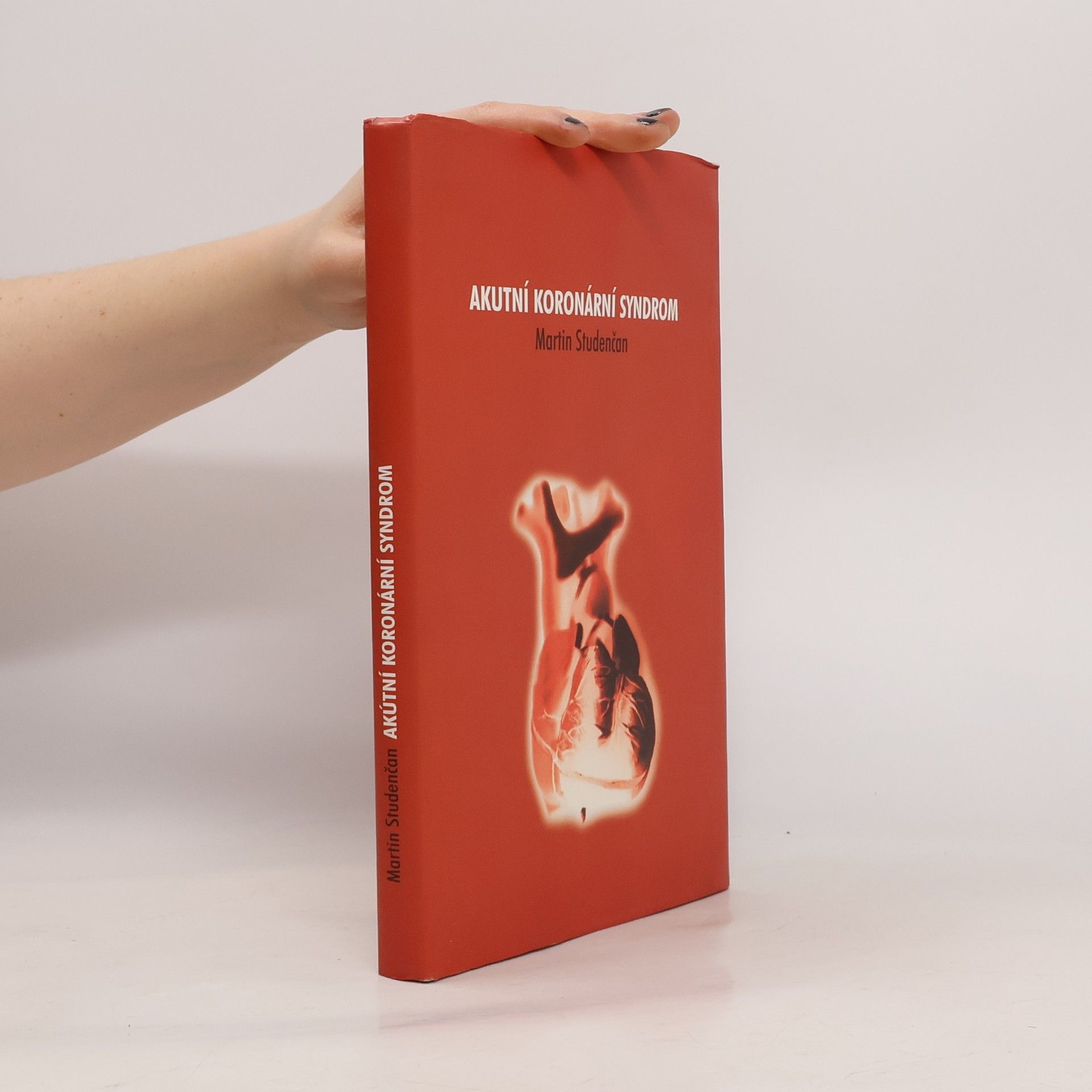 Akutní koronární syndrom