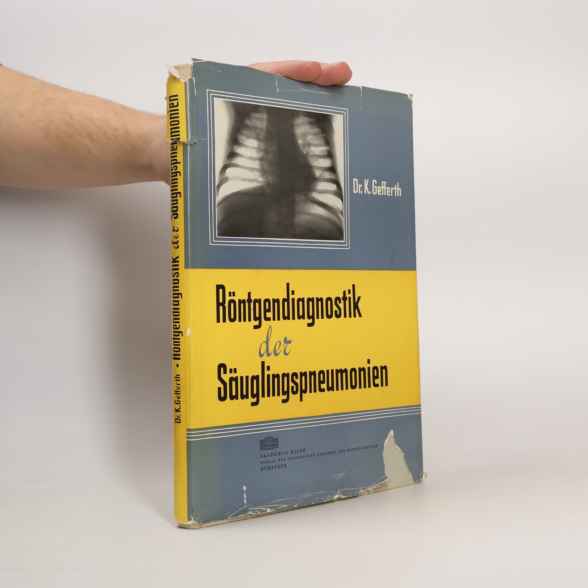 K Gefferth Röntgendiagnostik der Säuglingspneumonien