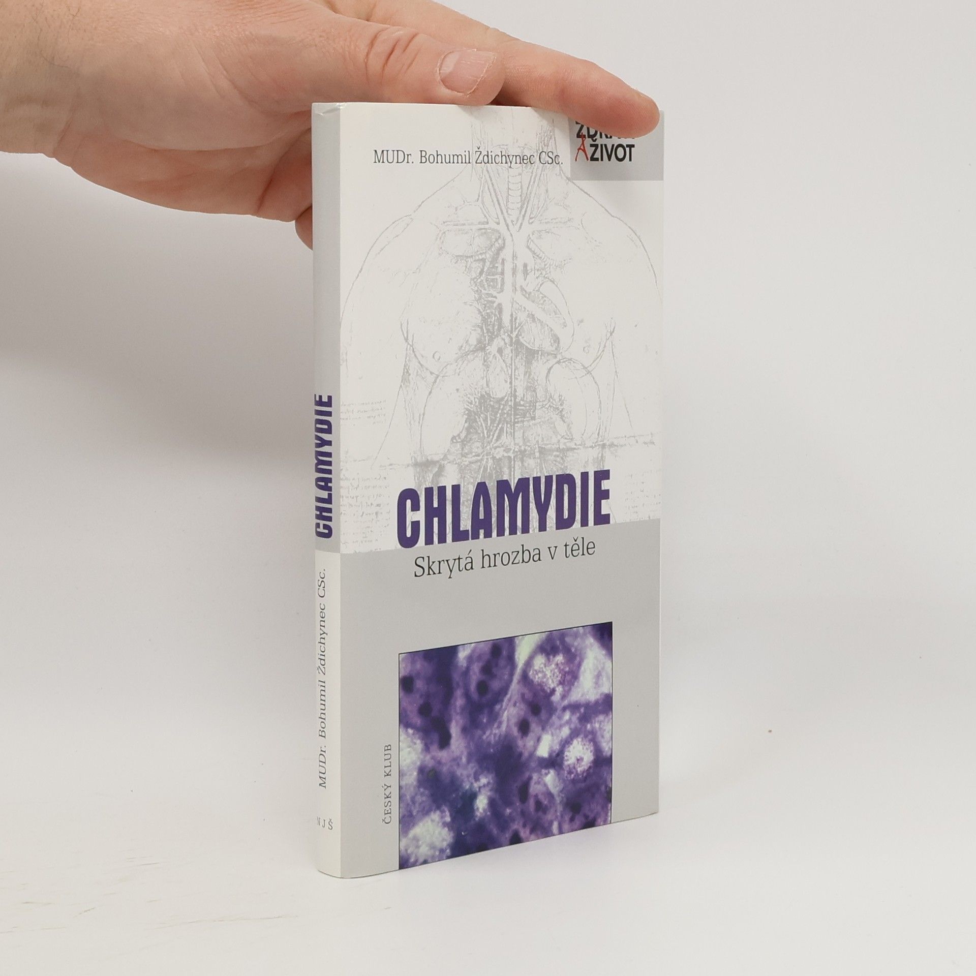 Bohumil Ždichynec Chlamydie. Skrytá hrozba v těle