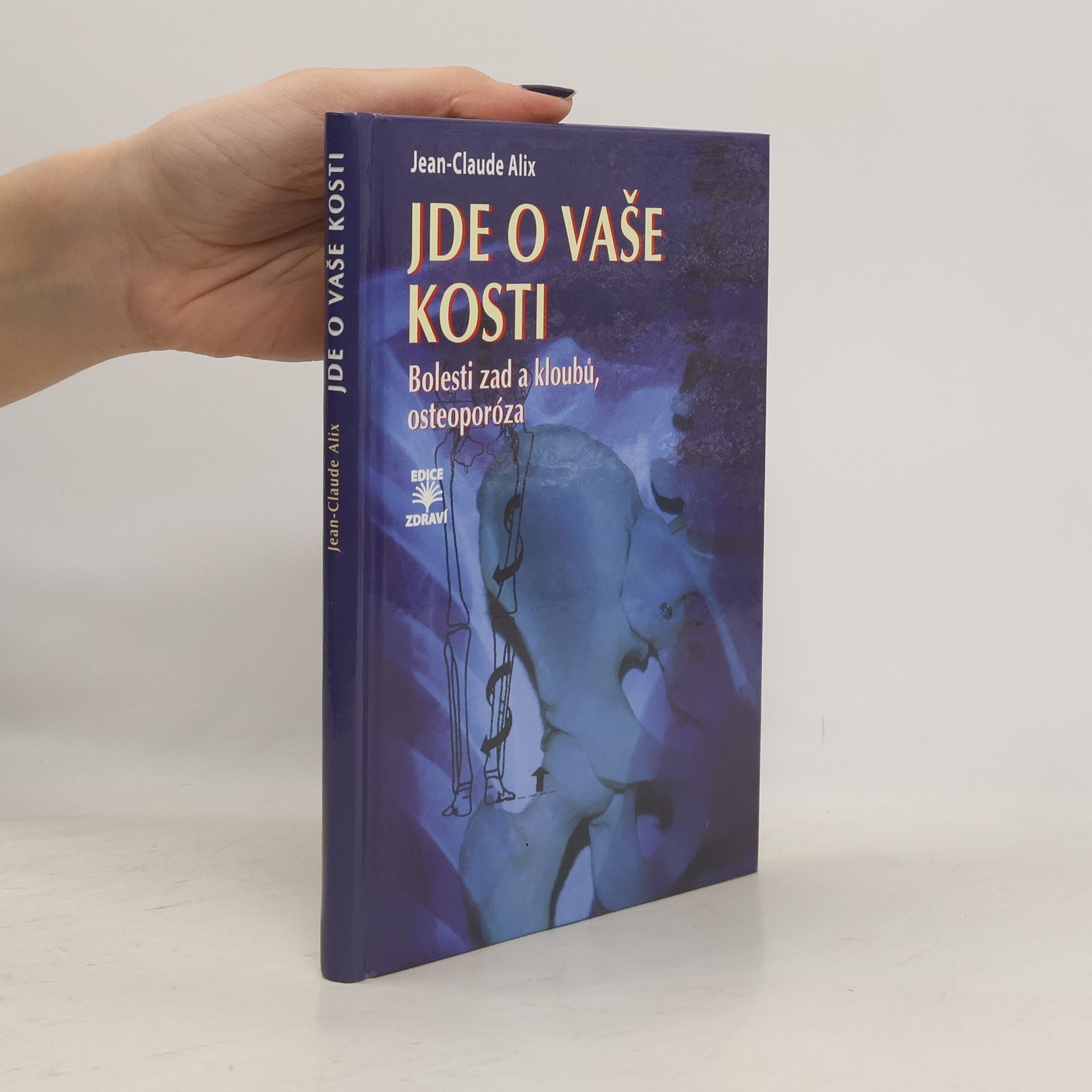 Jean-Claude Alix Jde o vaše kosti : bolesti zad a kloubů, osteoporóza