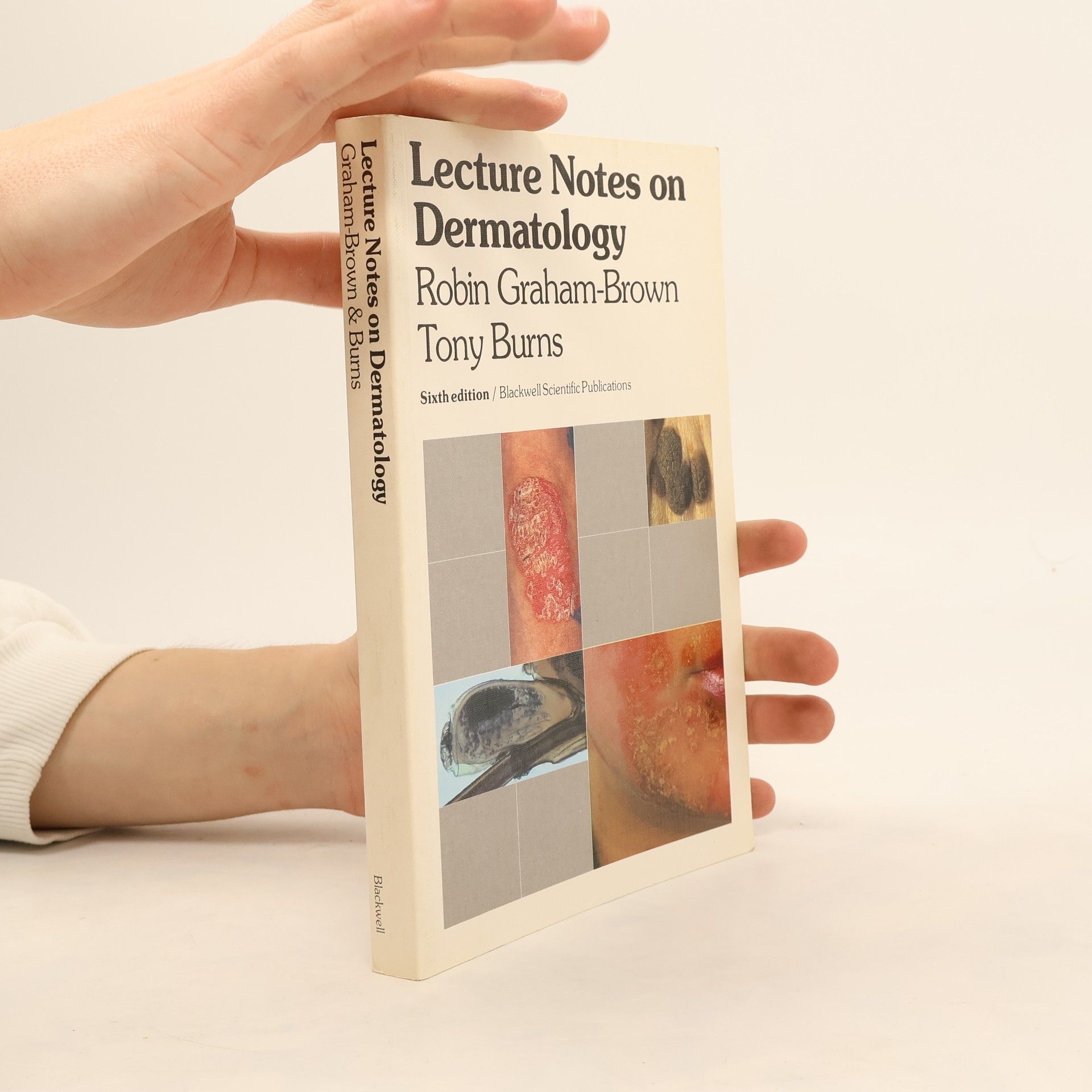 Graham-Brown Robin Lecture Notes on Dermatology