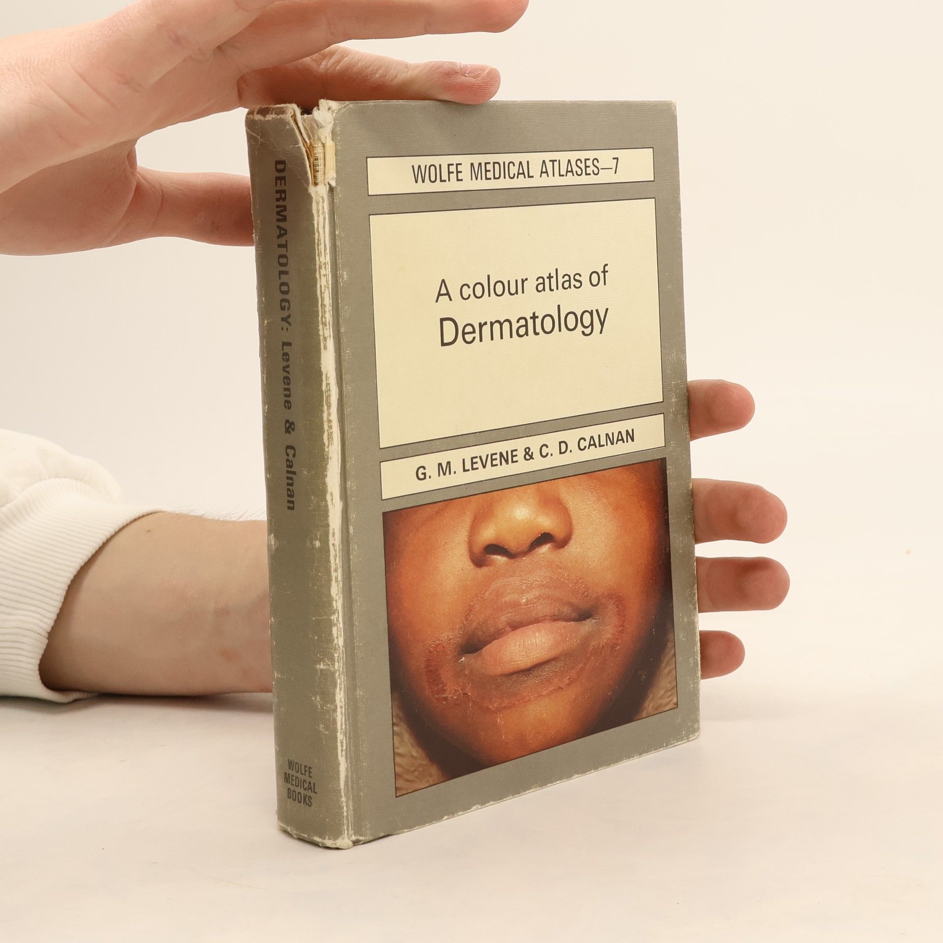 G. M. Levene A Colour Atlas of Dermatology