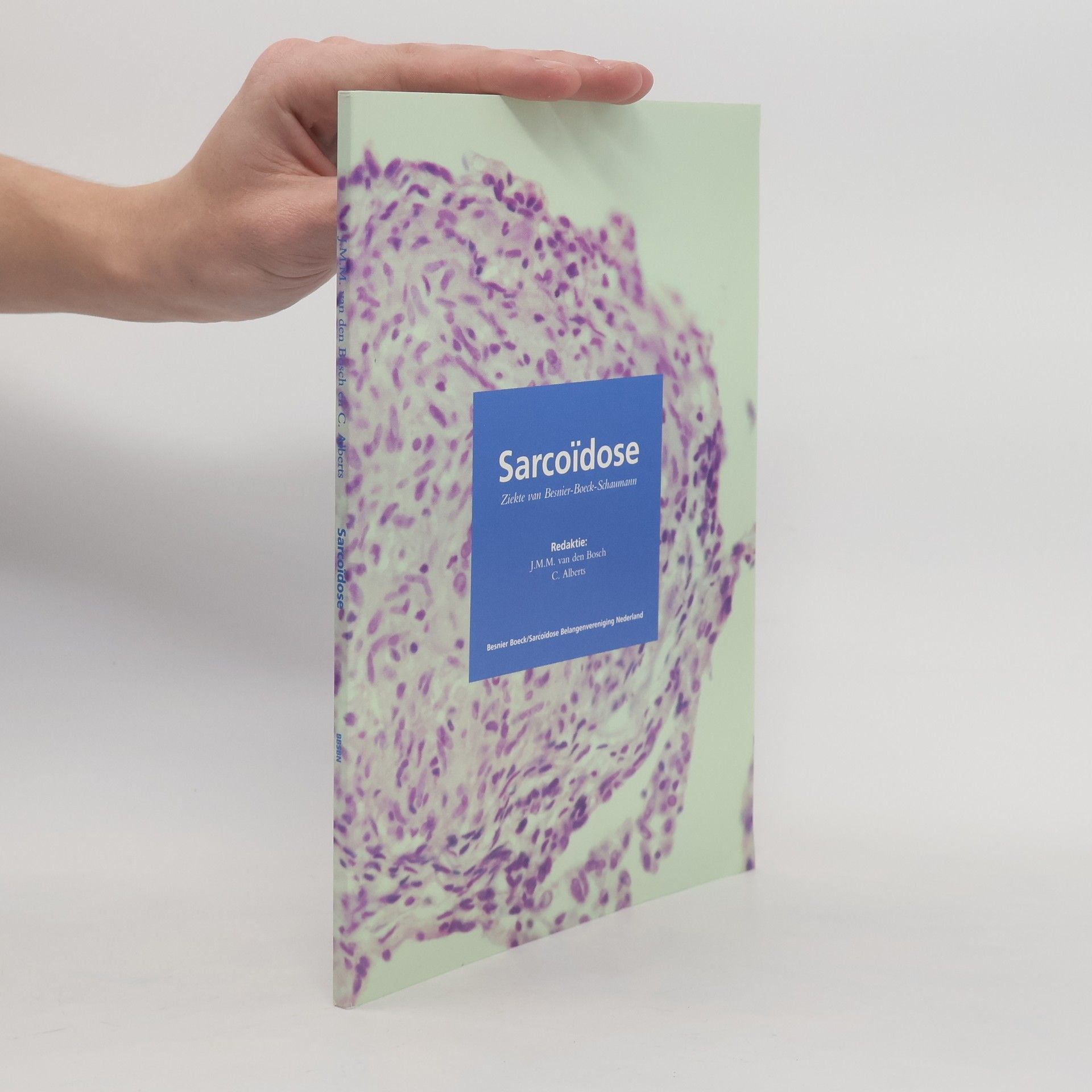 J. M. M. van den Bosch Sarcoïdose
