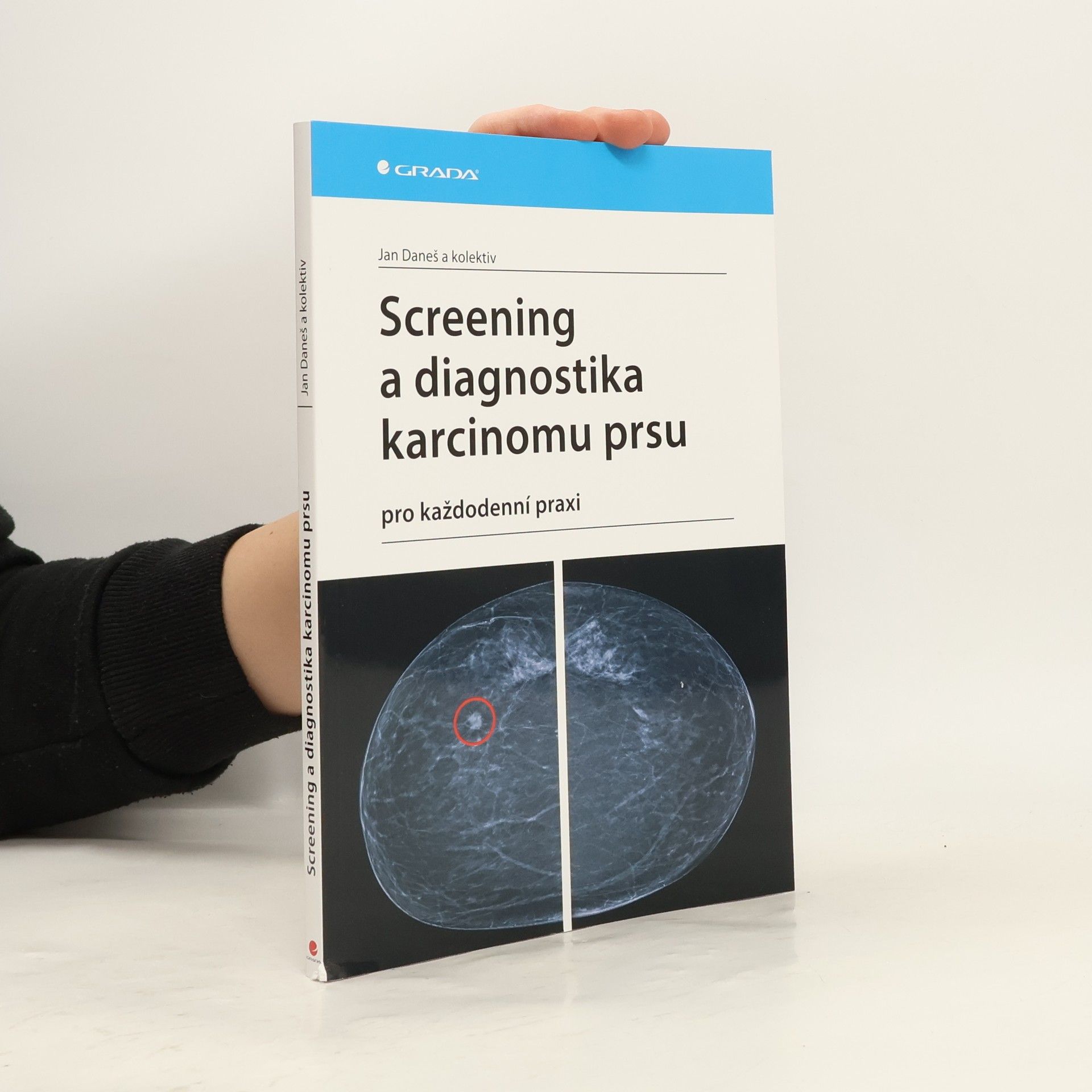 Jan Daneš Screening a diagnostika karcinomu prsu pro každodenní praxi