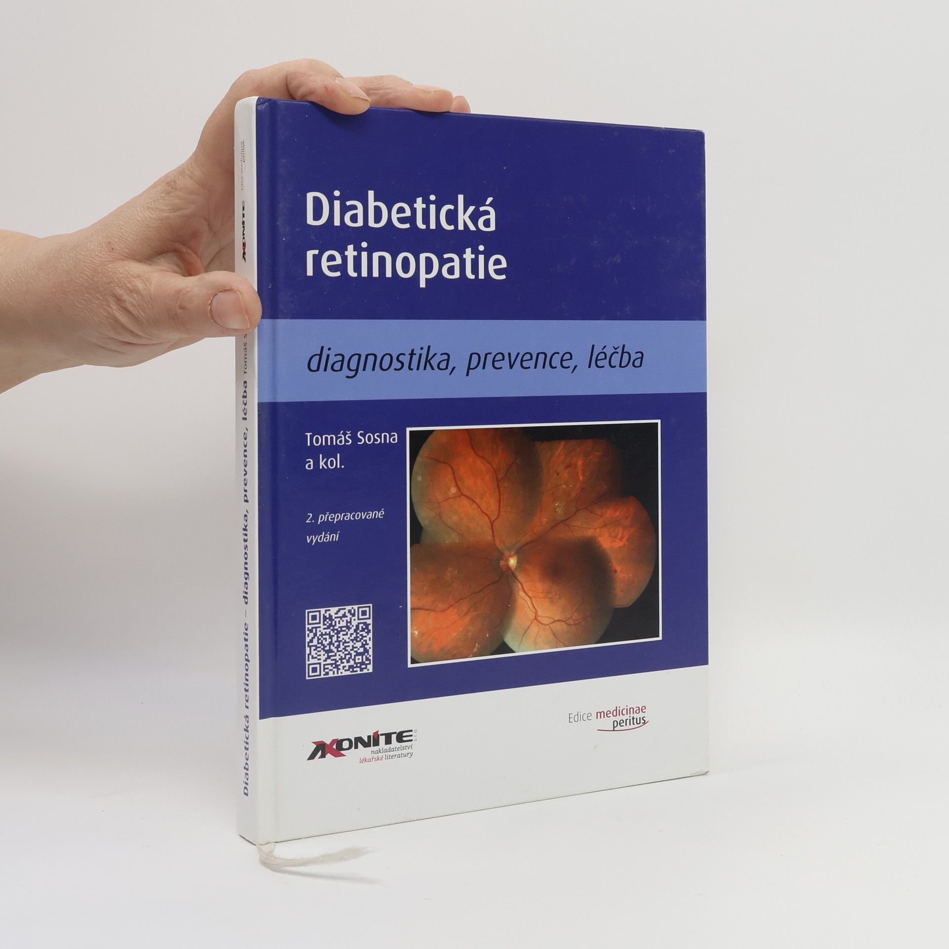 Diabetická retinopatie
