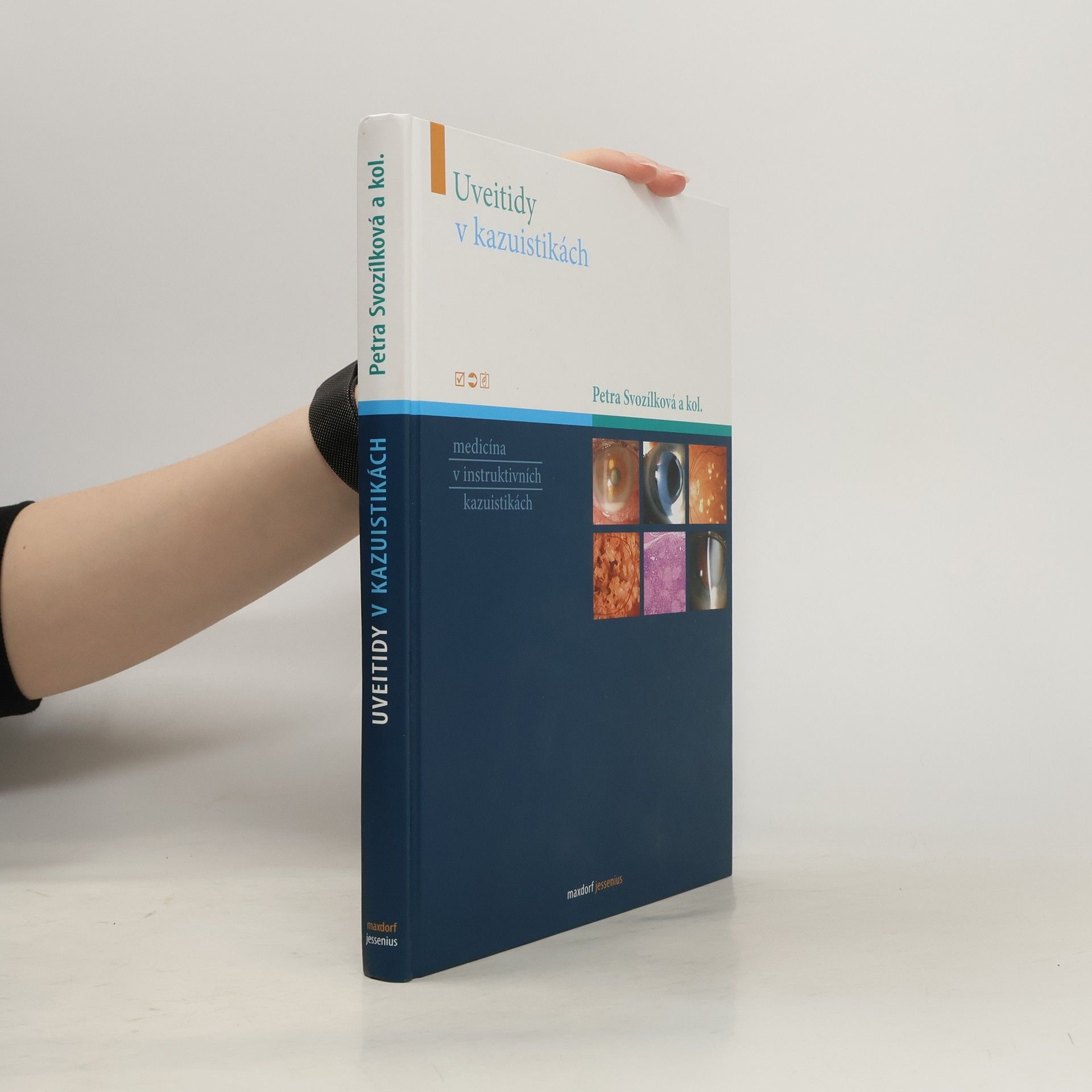 Petra Svozílková Uveitidy v kazuistikách