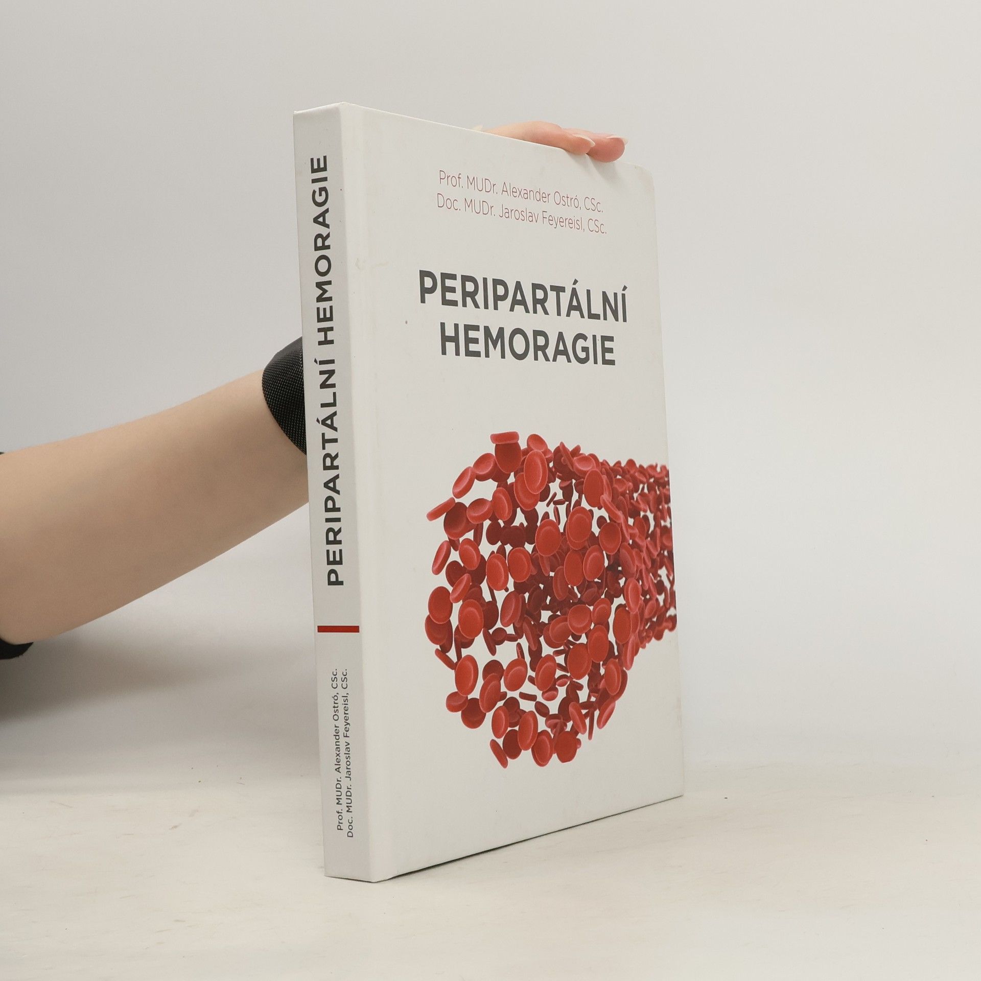 Peripartální hemoragie