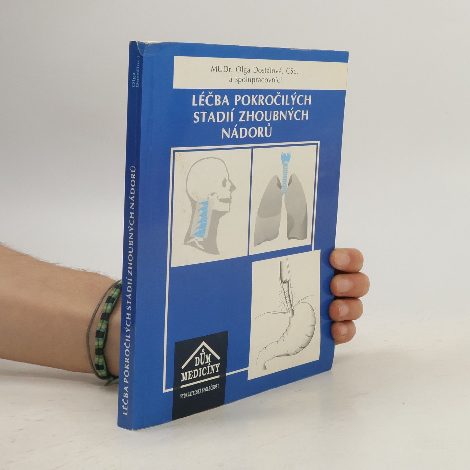 Olga Dostálová Léčba pokročilých stadií zhoubných nádorů