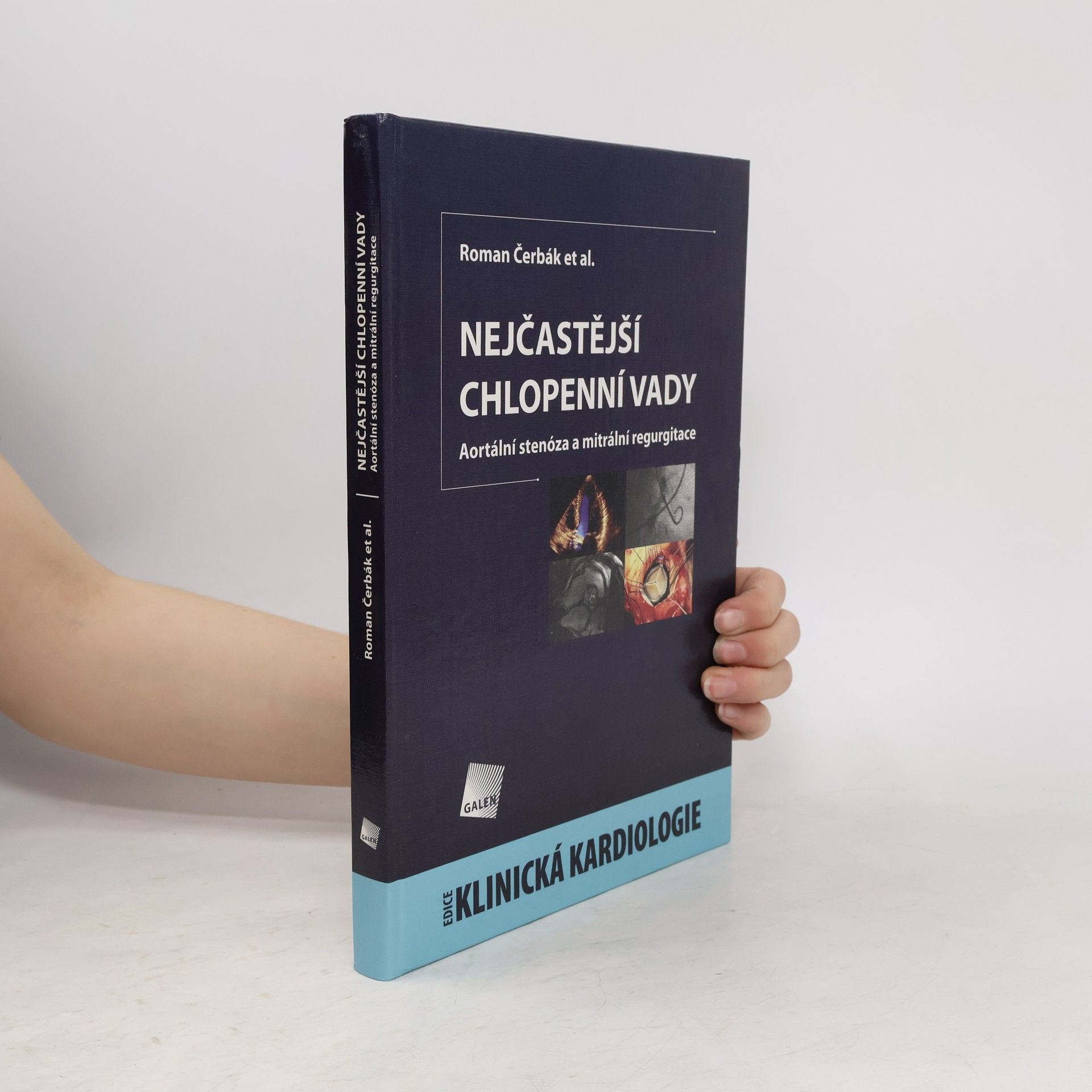 Nejčastější chlopenní vady - Aortální stenóza a mitrální regurgitace