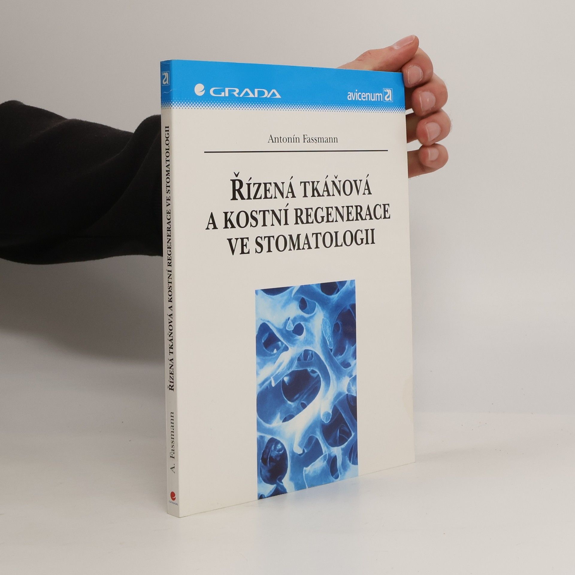 Antonín Fassmann Řízená tkáňová a kostní regenerace ve stomatologii