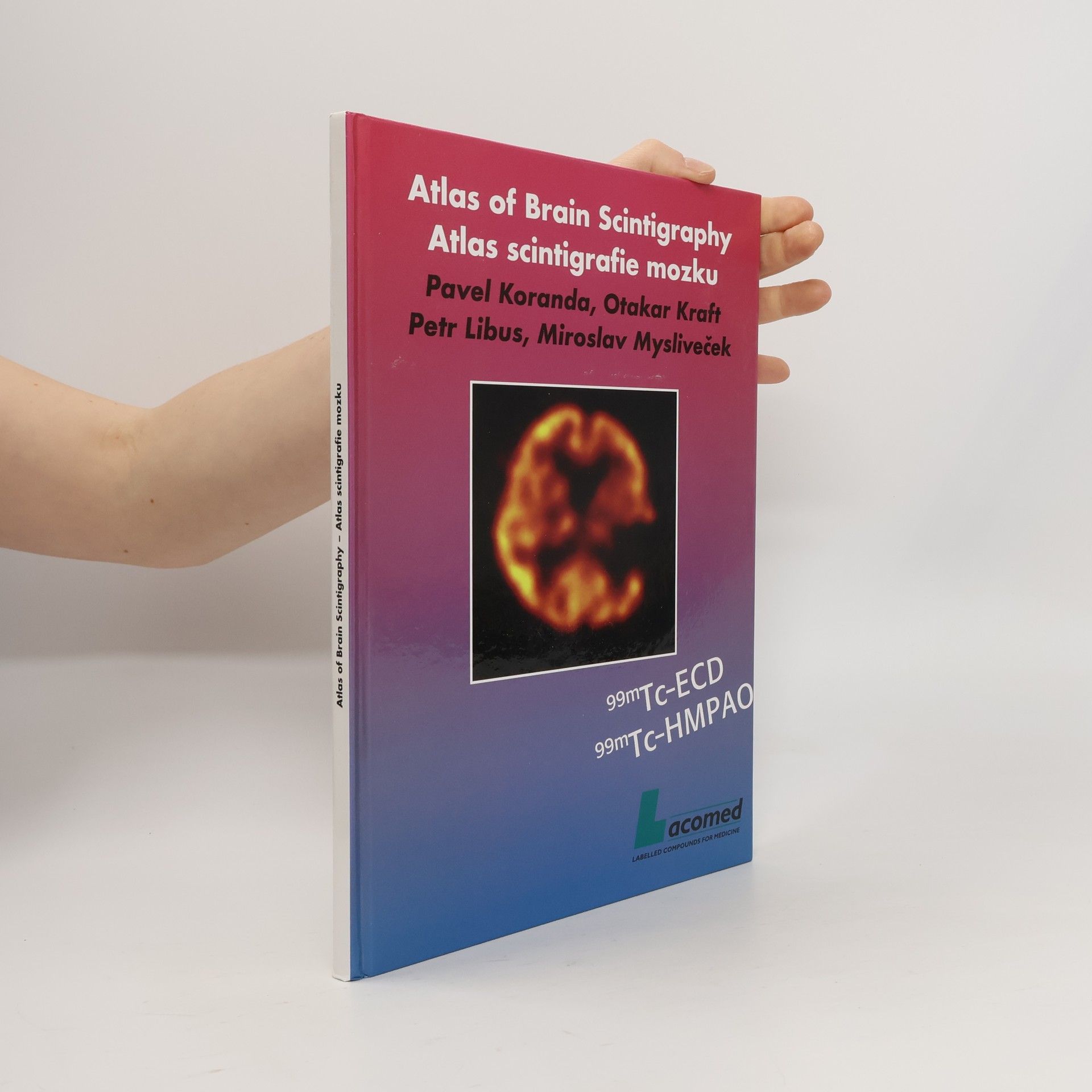 kolektiv Atlas scintigrafie mozku = Atlas of brain scintigraphy